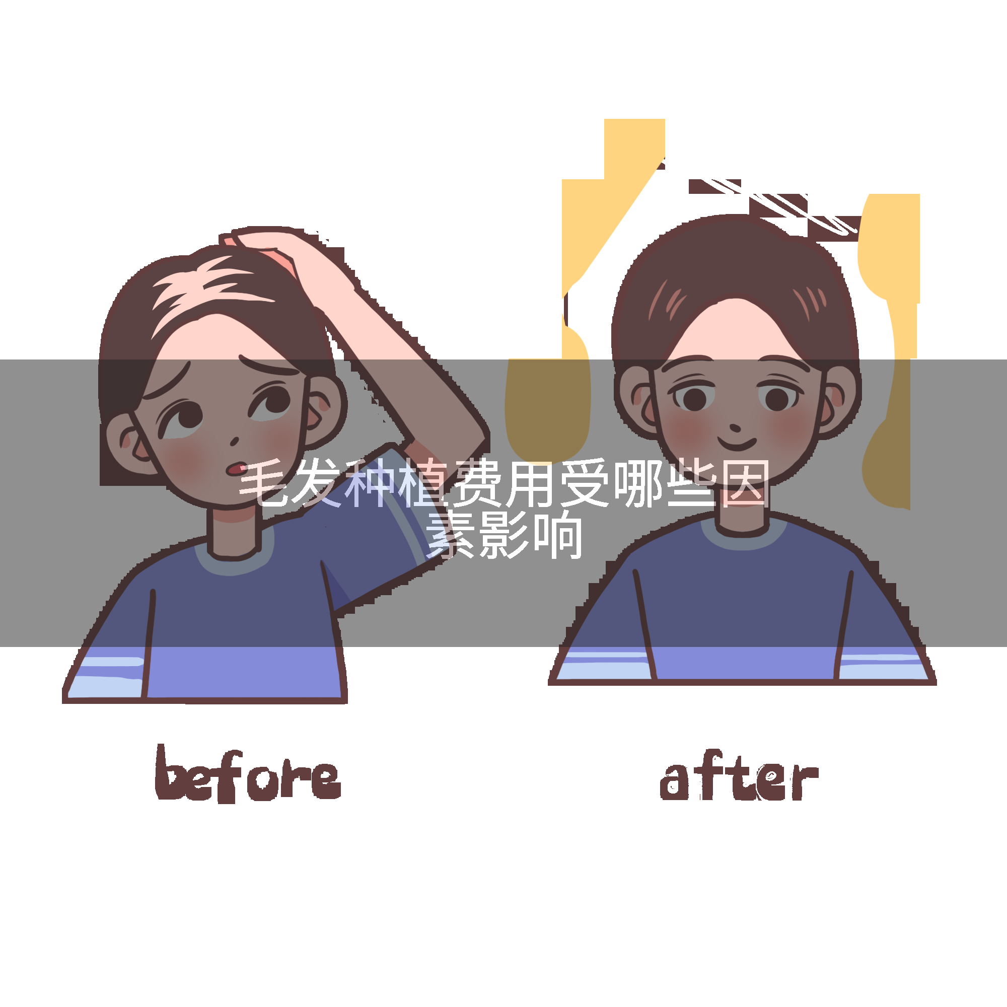 毛发种植费用受哪些因素影响