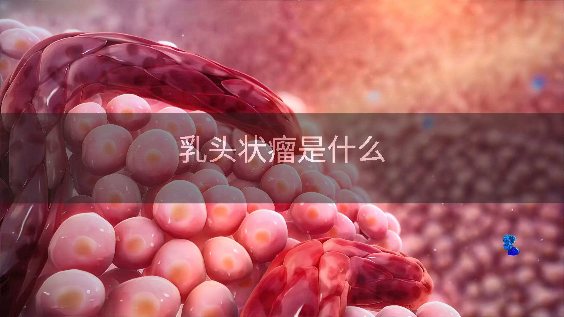 乳头状瘤是什么