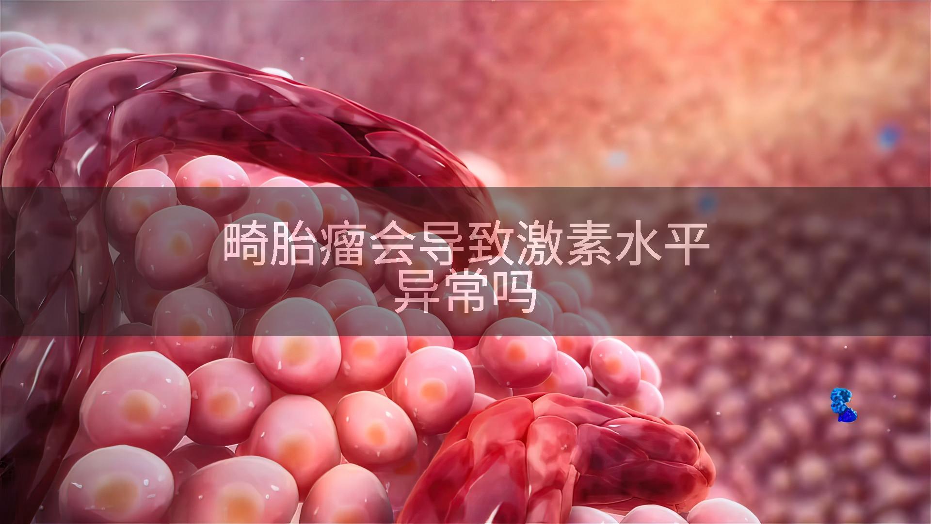 畸胎瘤会导致激素水平异常吗