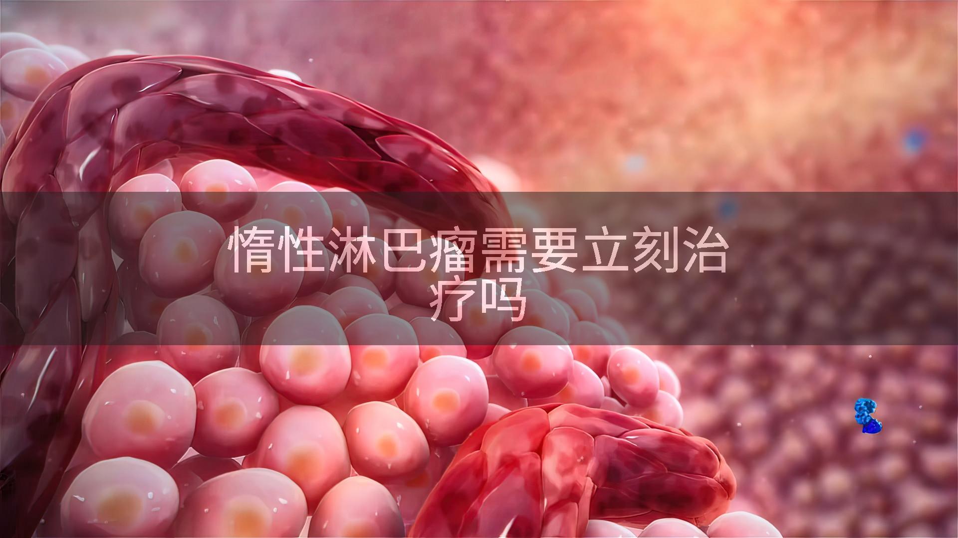 惰性淋巴瘤需要立刻治疗吗