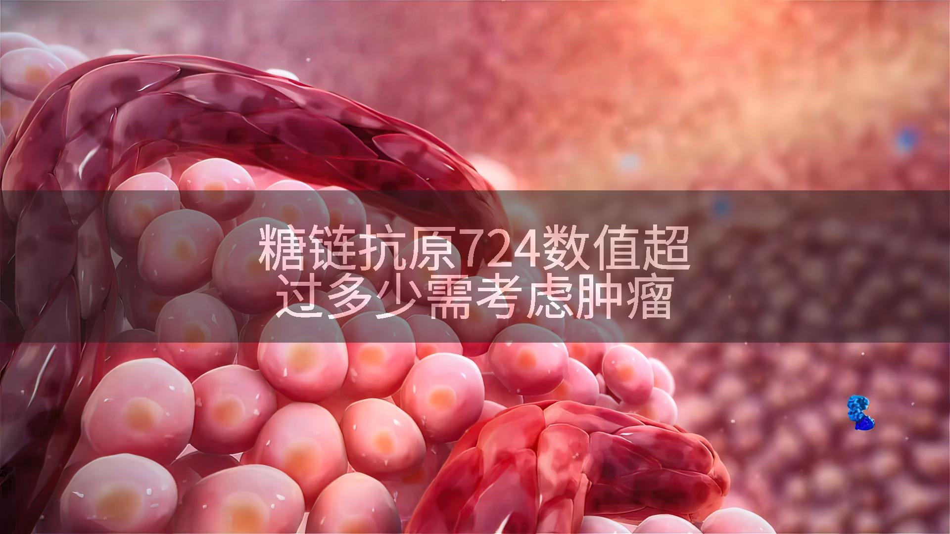 糖链抗原724数值超过多少需考虑肿瘤