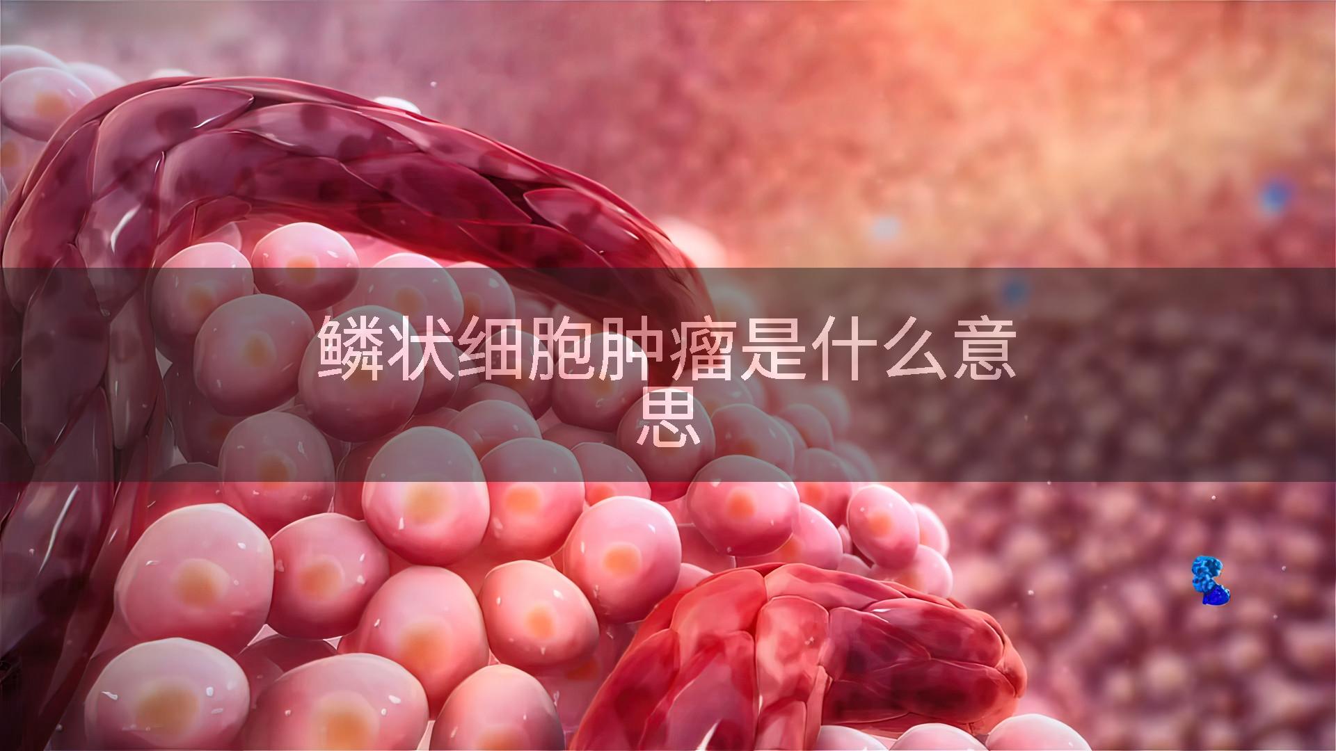 鳞状细胞肿瘤是什么意思