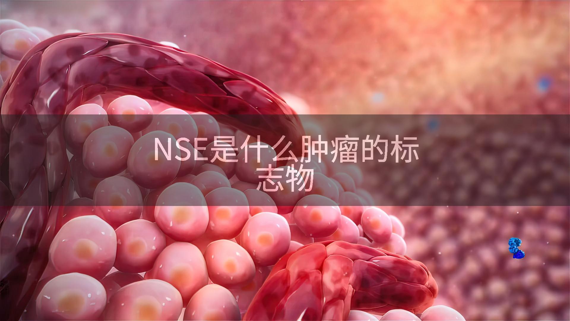 NSE是什么肿瘤的标志物