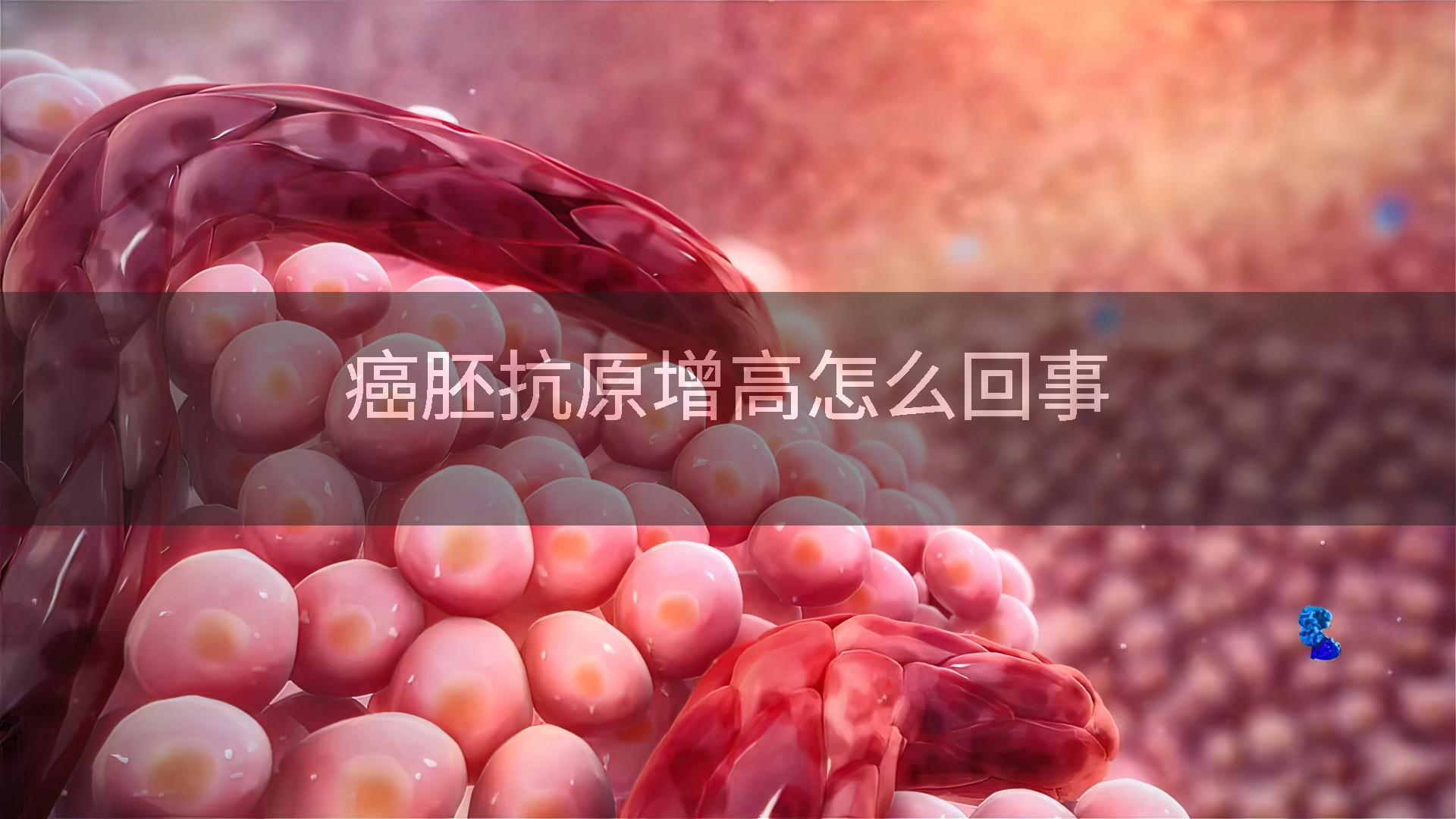 癌胚抗原增高怎么回事
