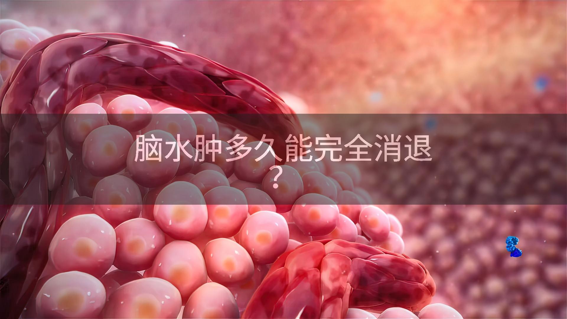 脑水肿多久能完全消退？