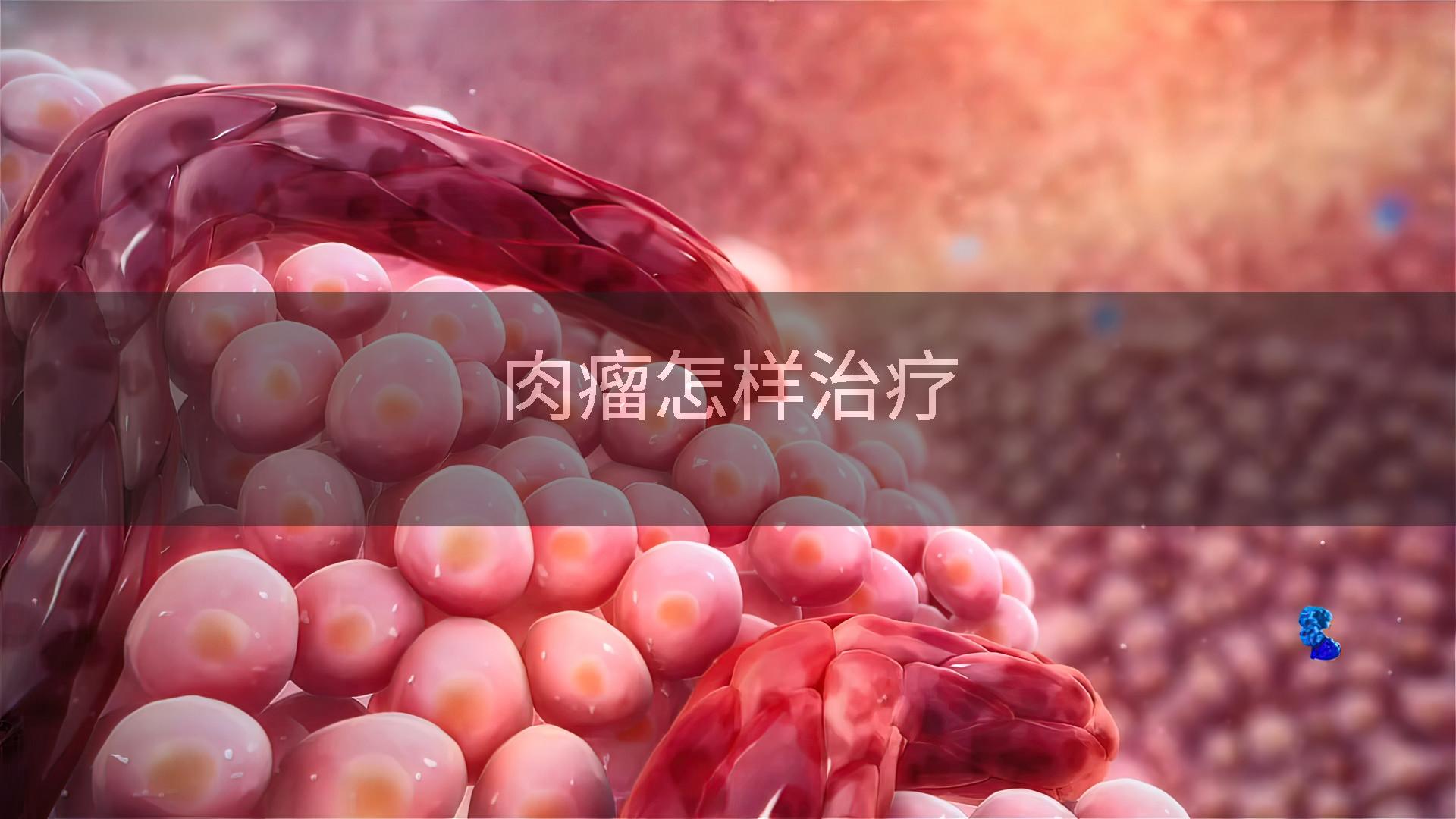 肉瘤怎样治疗