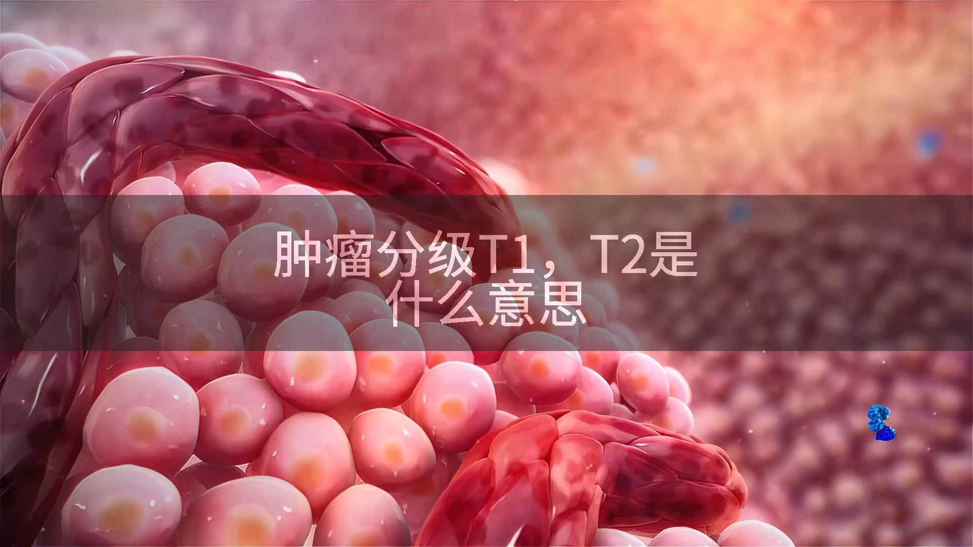肿瘤分级T1，T2是什么意思
