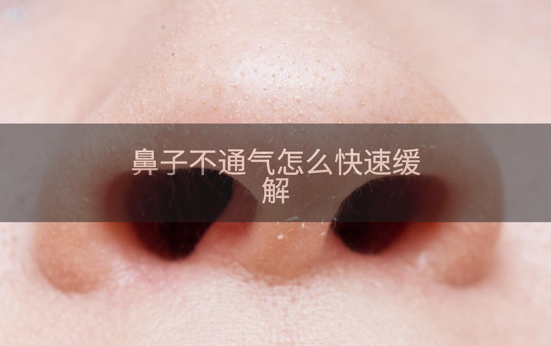 鼻子不通气怎么快速缓解