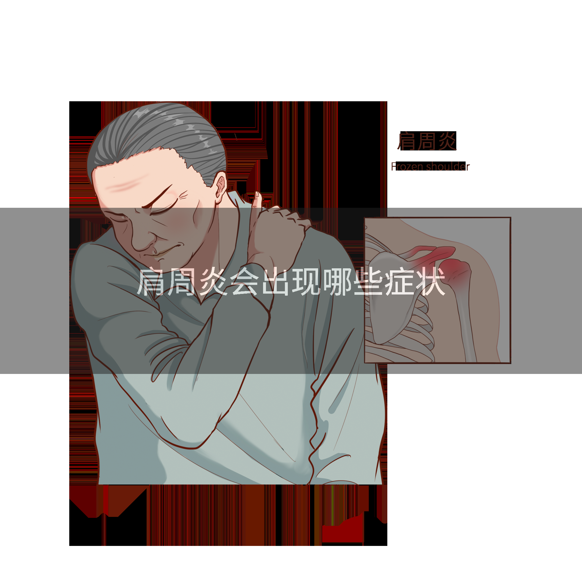肩周炎會出現哪些症狀