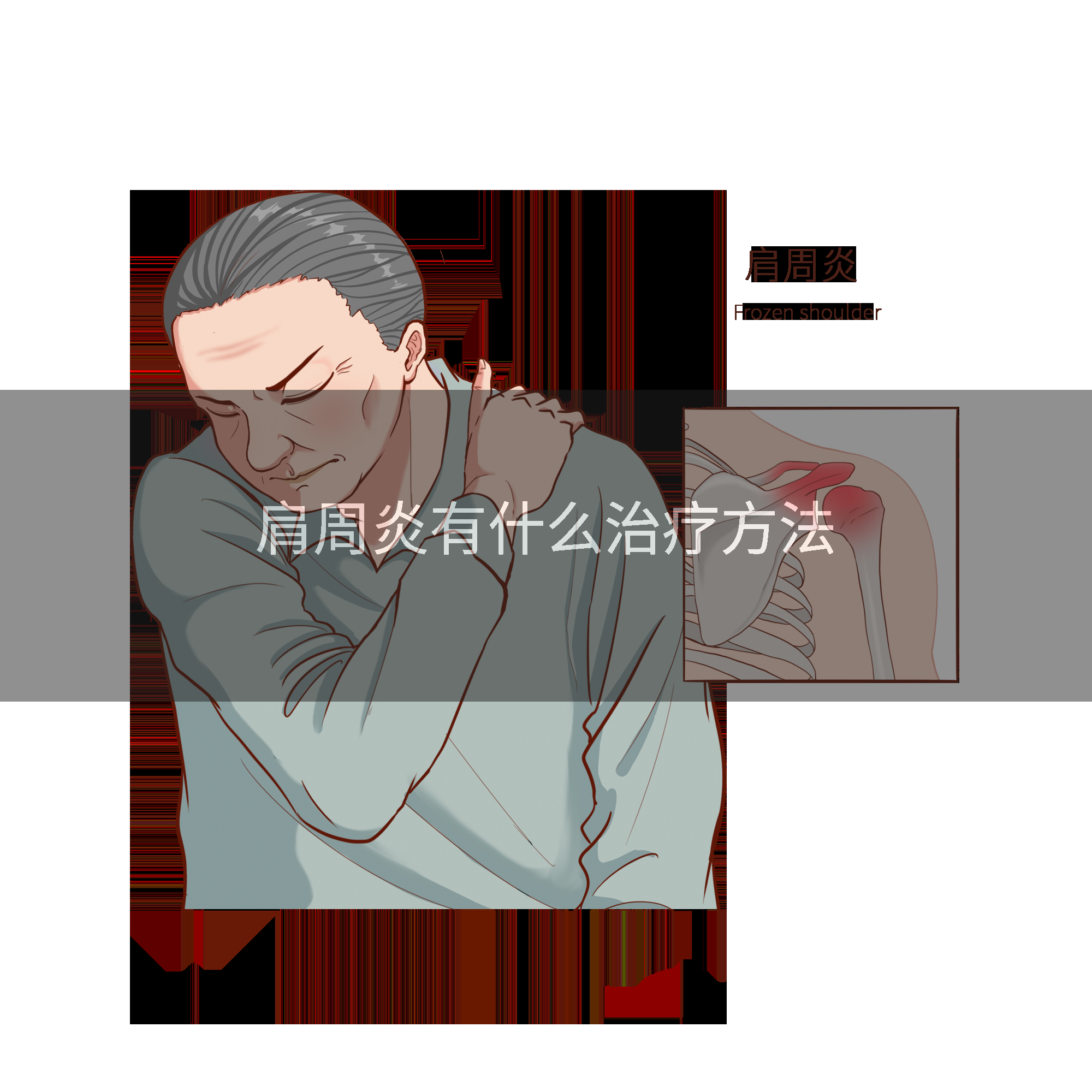 肩周炎有什么治疗方法
