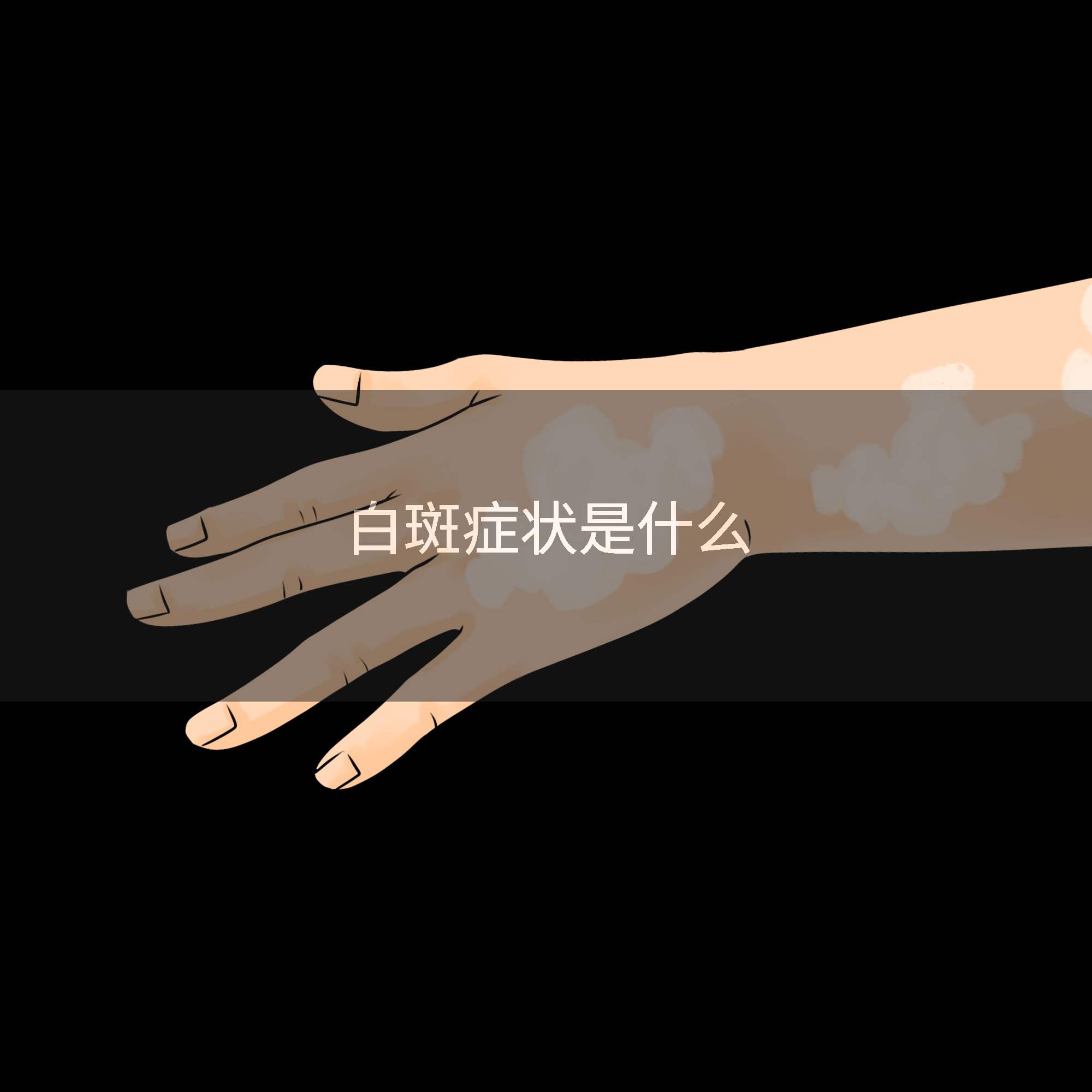 白斑症状是什么