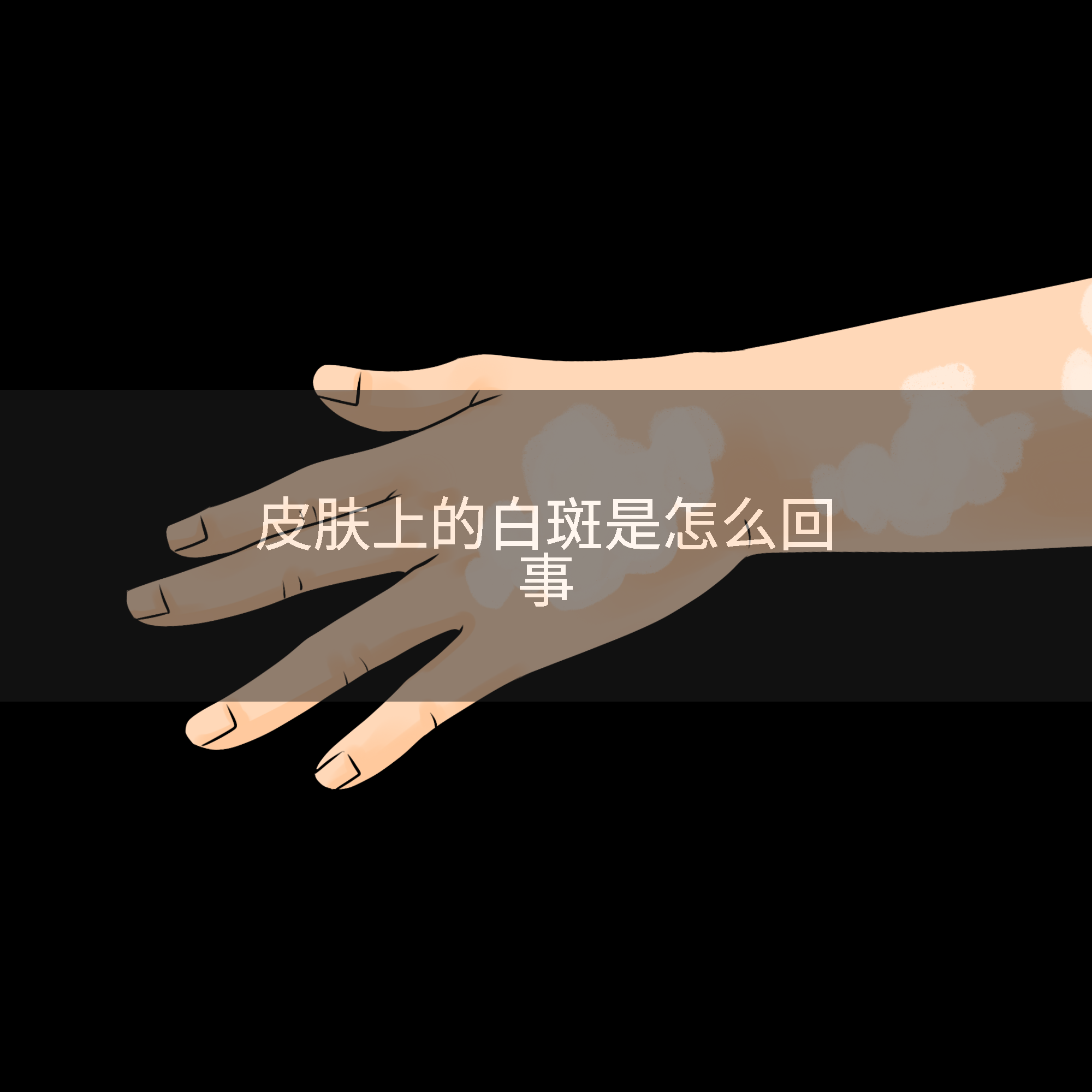皮肤上的白斑是怎么回事