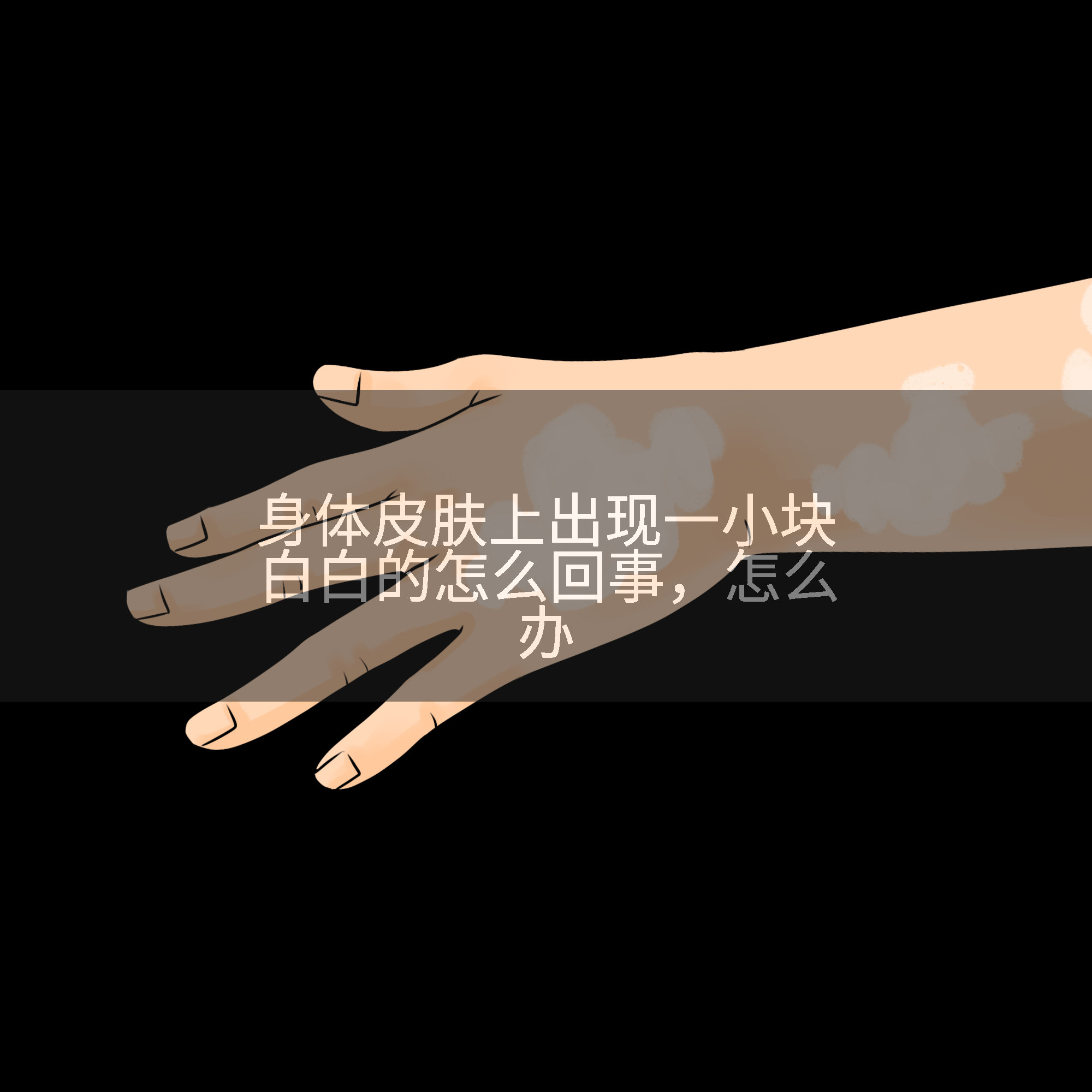 身体皮肤上出现一小块白白的怎么回事，怎么办