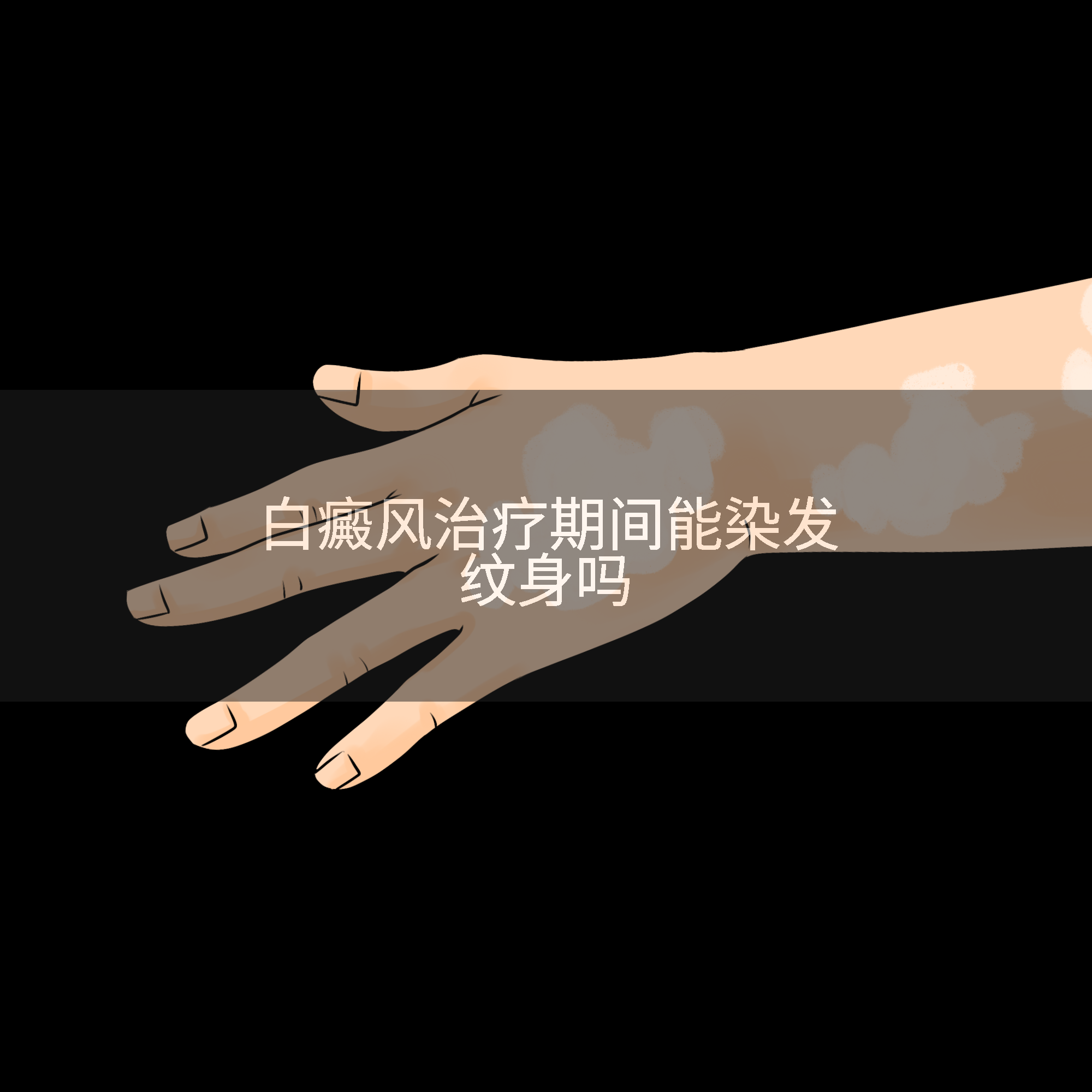 白癜风治疗期间能染发纹身吗