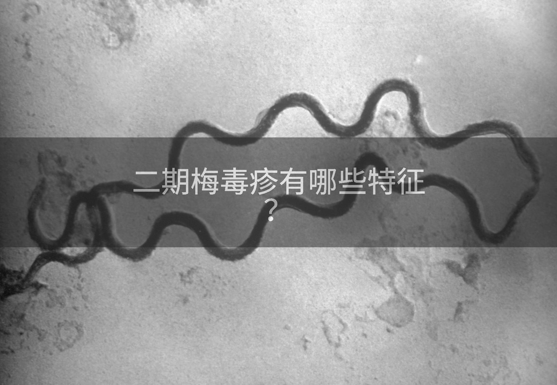 二期梅毒疹有哪些特征？