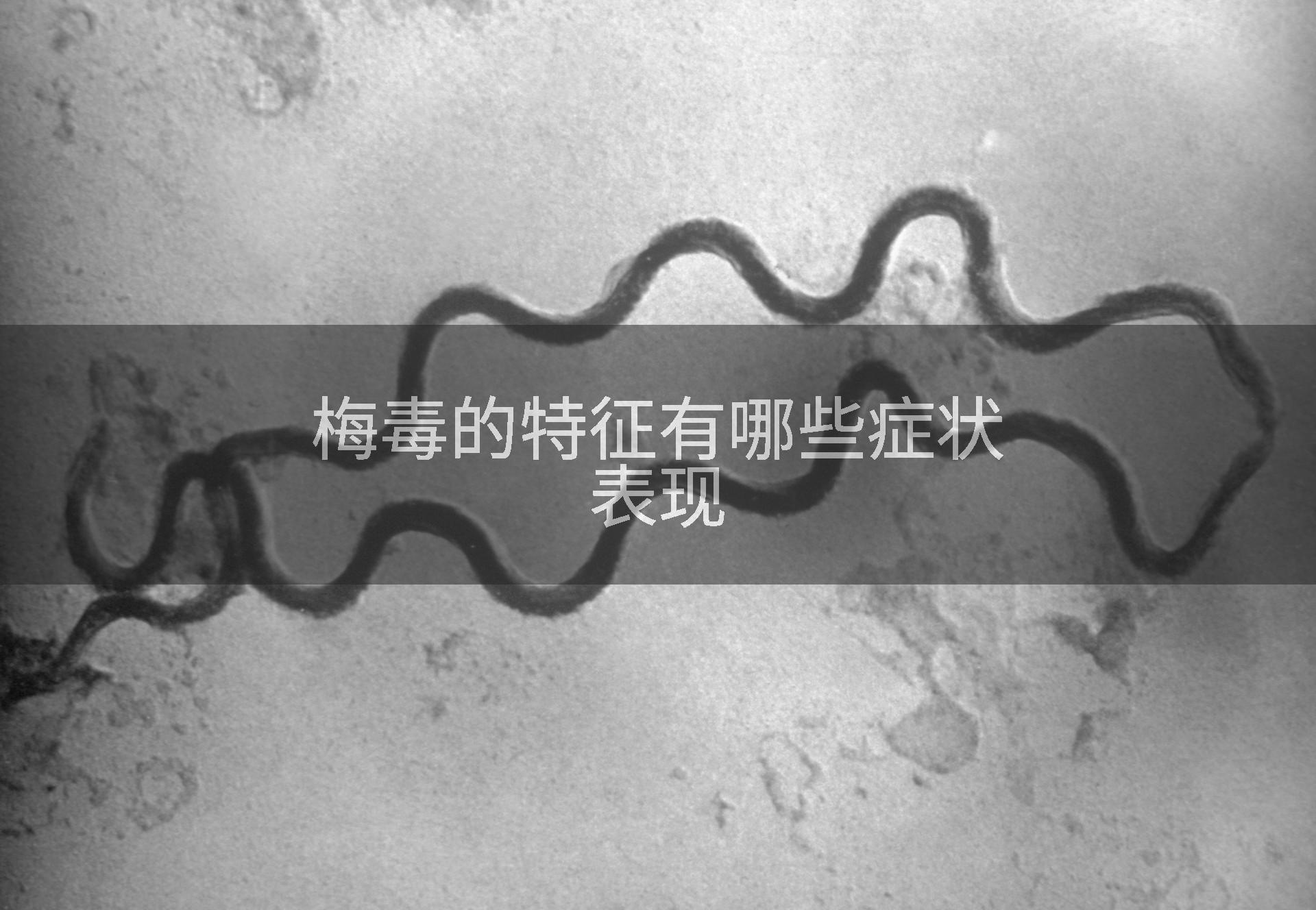 梅毒的特征有哪些症状表现