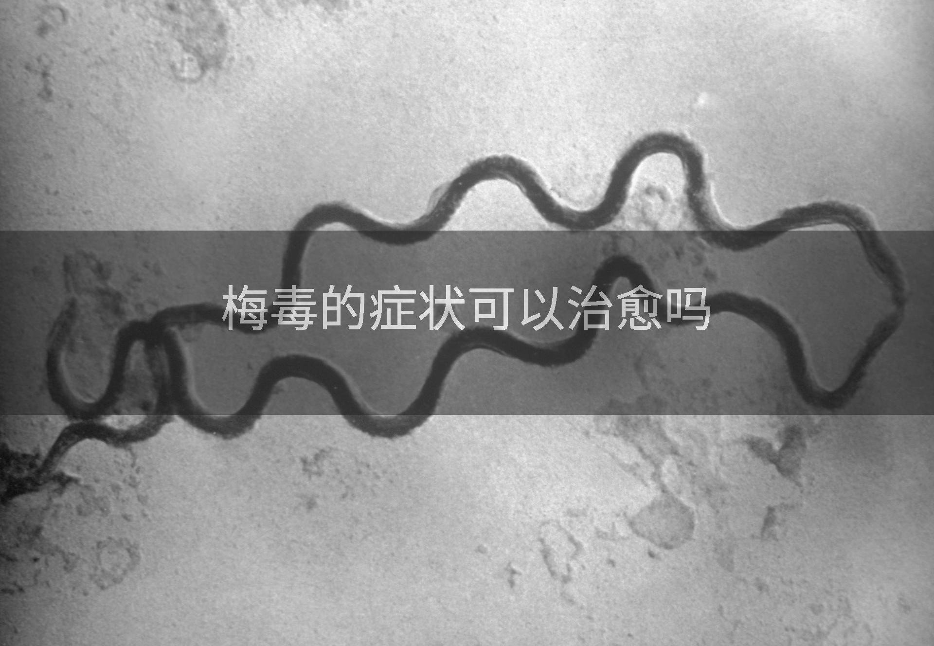 梅毒的症状可以治愈吗