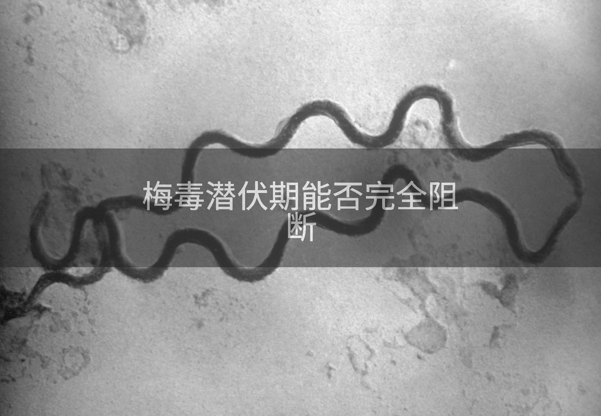 梅毒潜伏期能否完全阻断