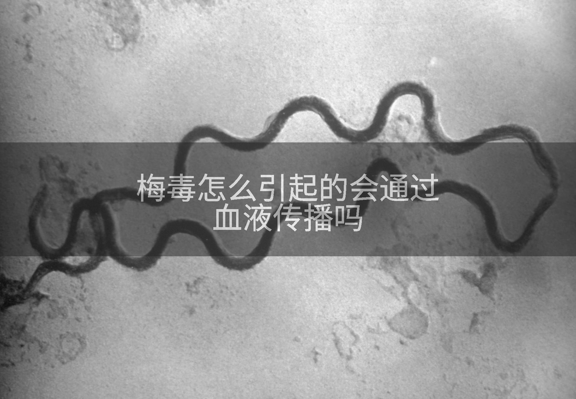 梅毒怎么引起的会通过血液传播吗