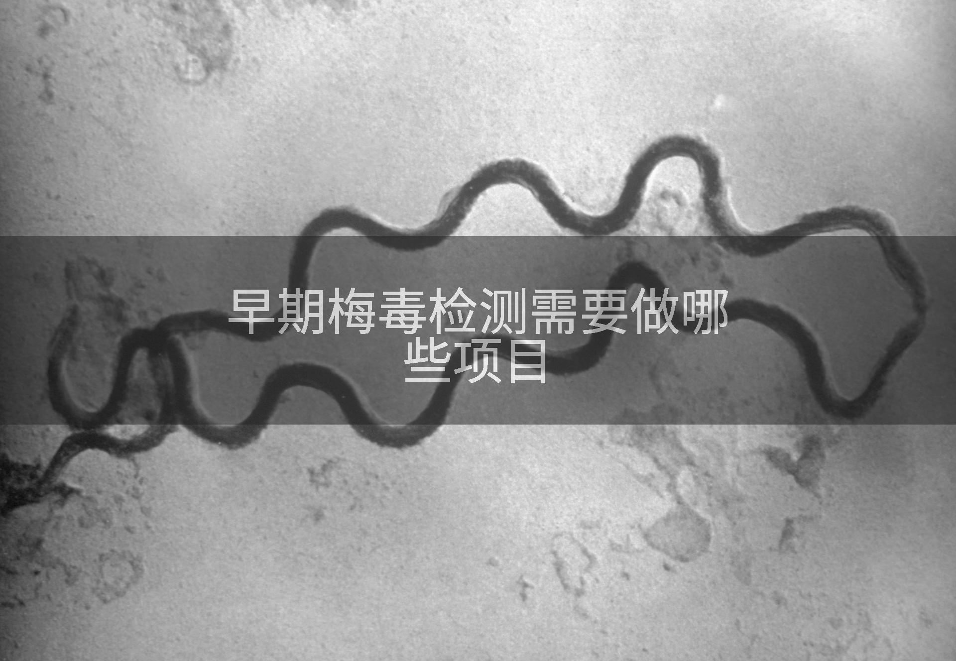 早期梅毒检测需要做哪些项目