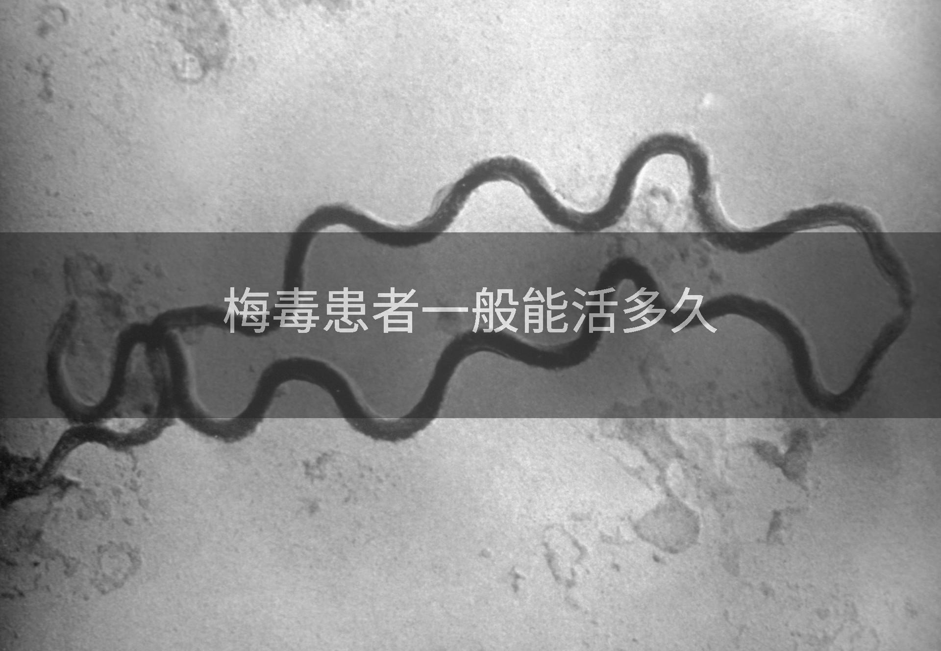 梅毒患者一般能活多久