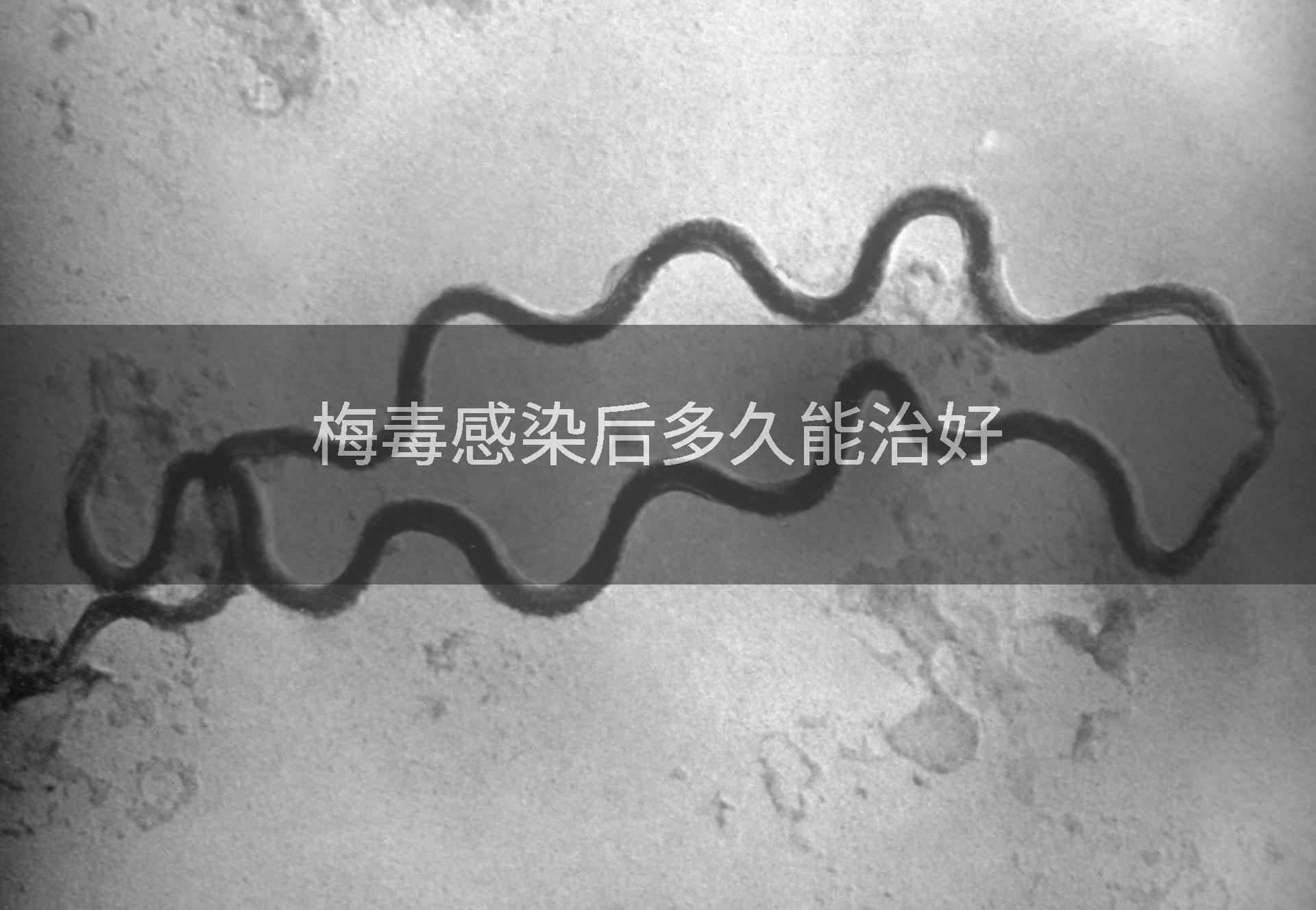 梅毒感染后多久能治好