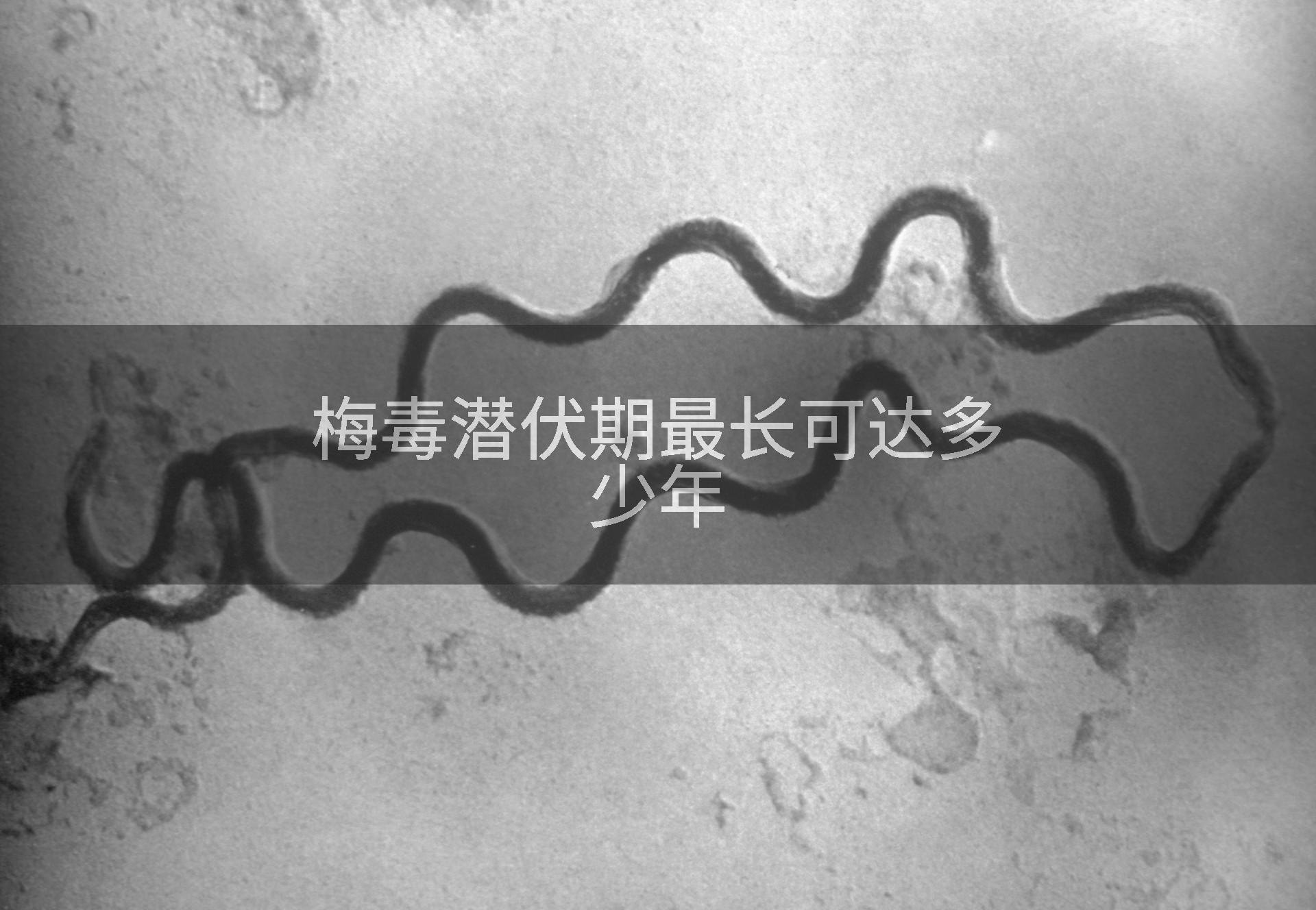 梅毒潜伏期最长可达多少年