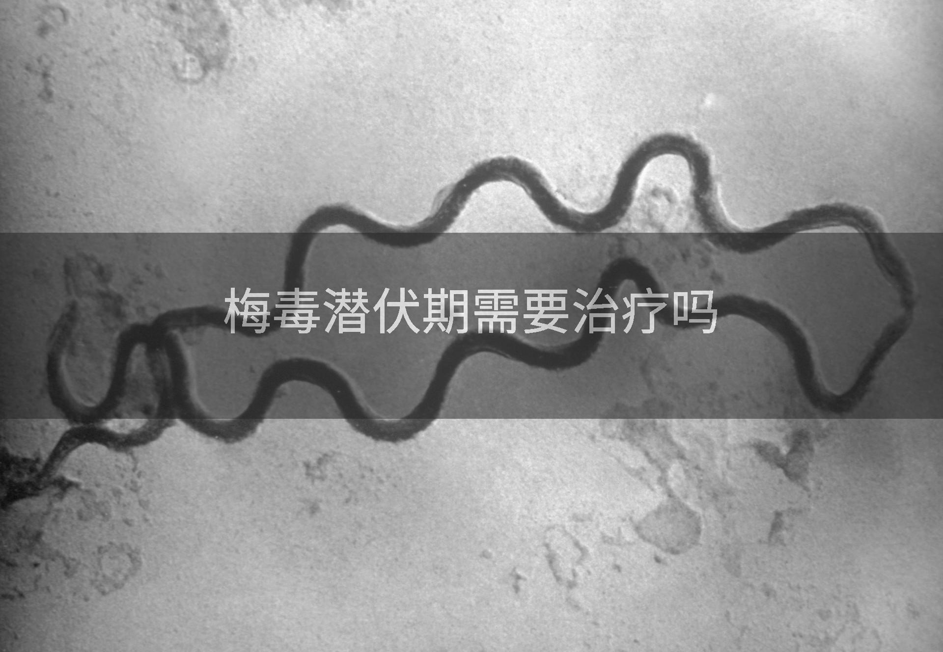 梅毒潜伏期需要治疗吗