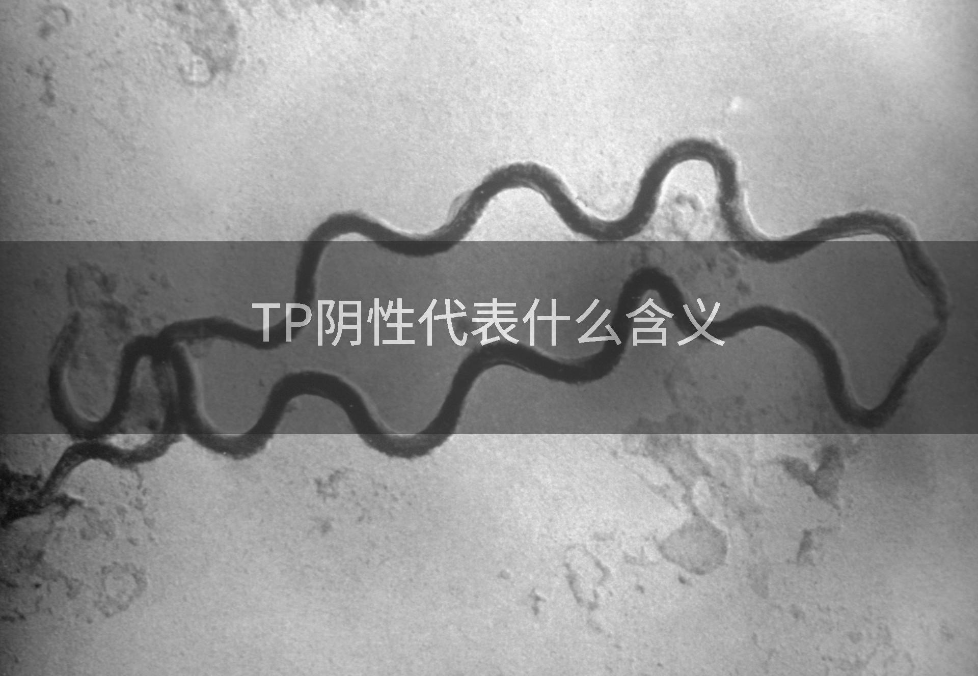 TP阴性代表什么含义