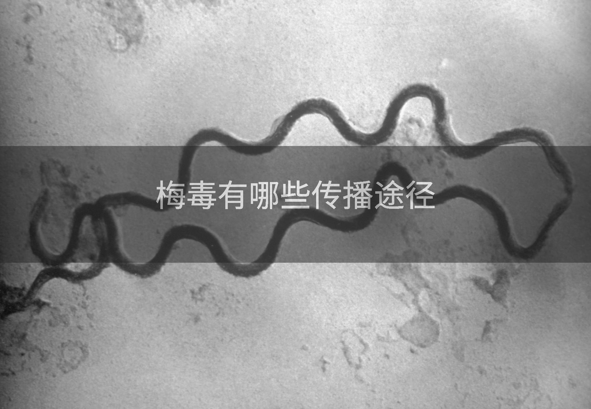 梅毒有哪些传播途径