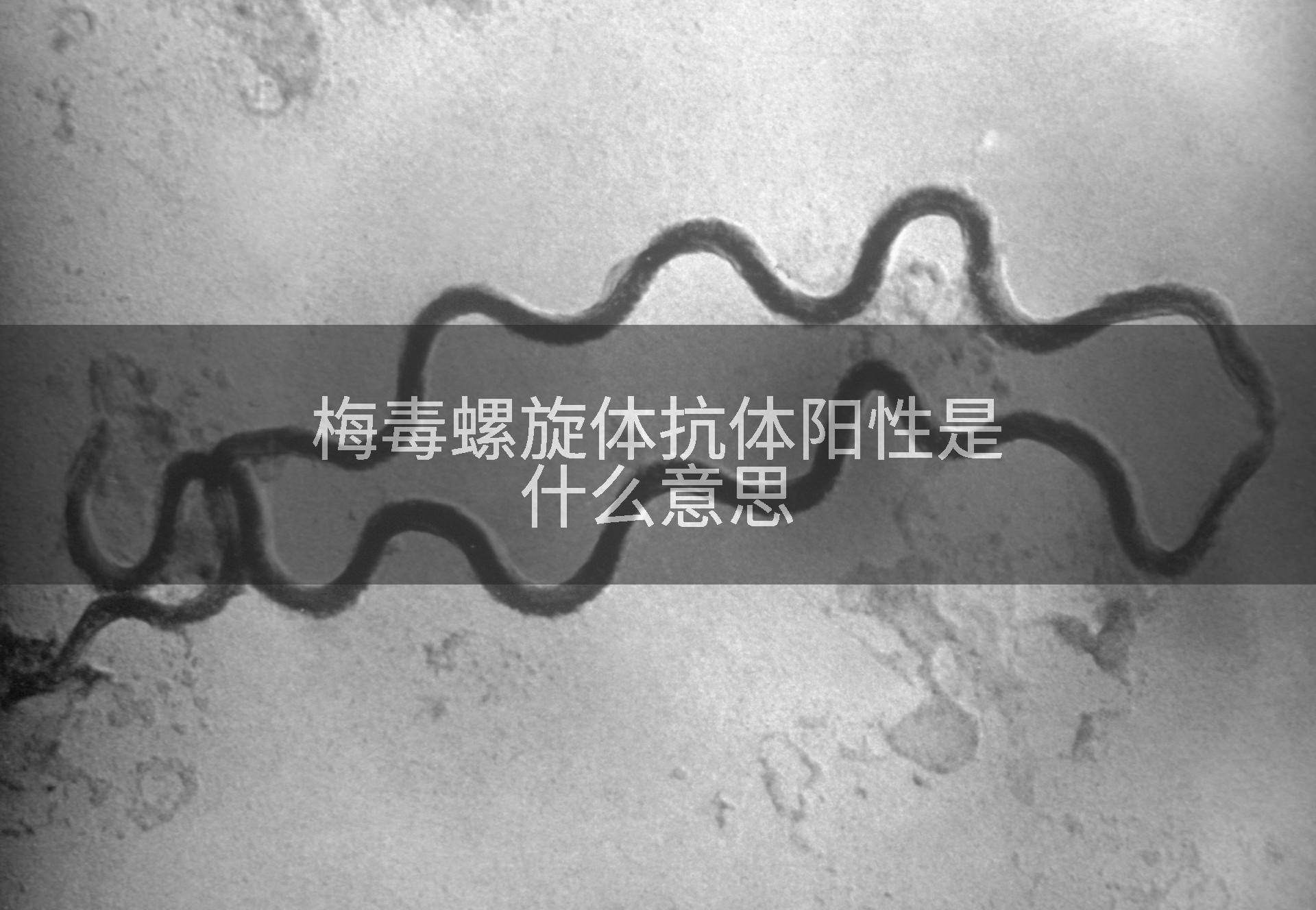 梅毒螺旋体抗体阳性是什么意思