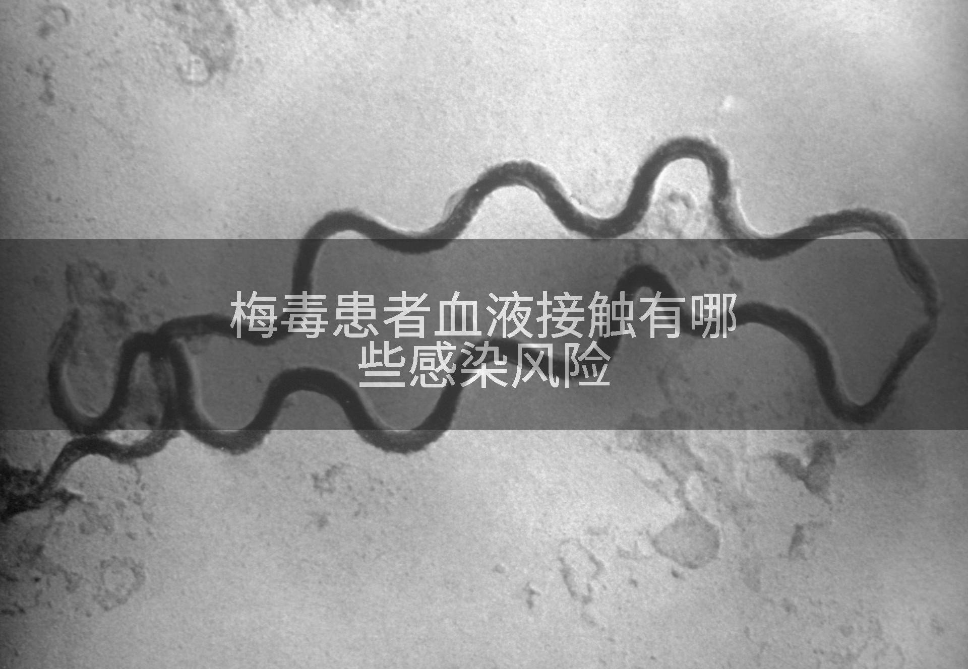 梅毒患者血液接触有哪些感染风险