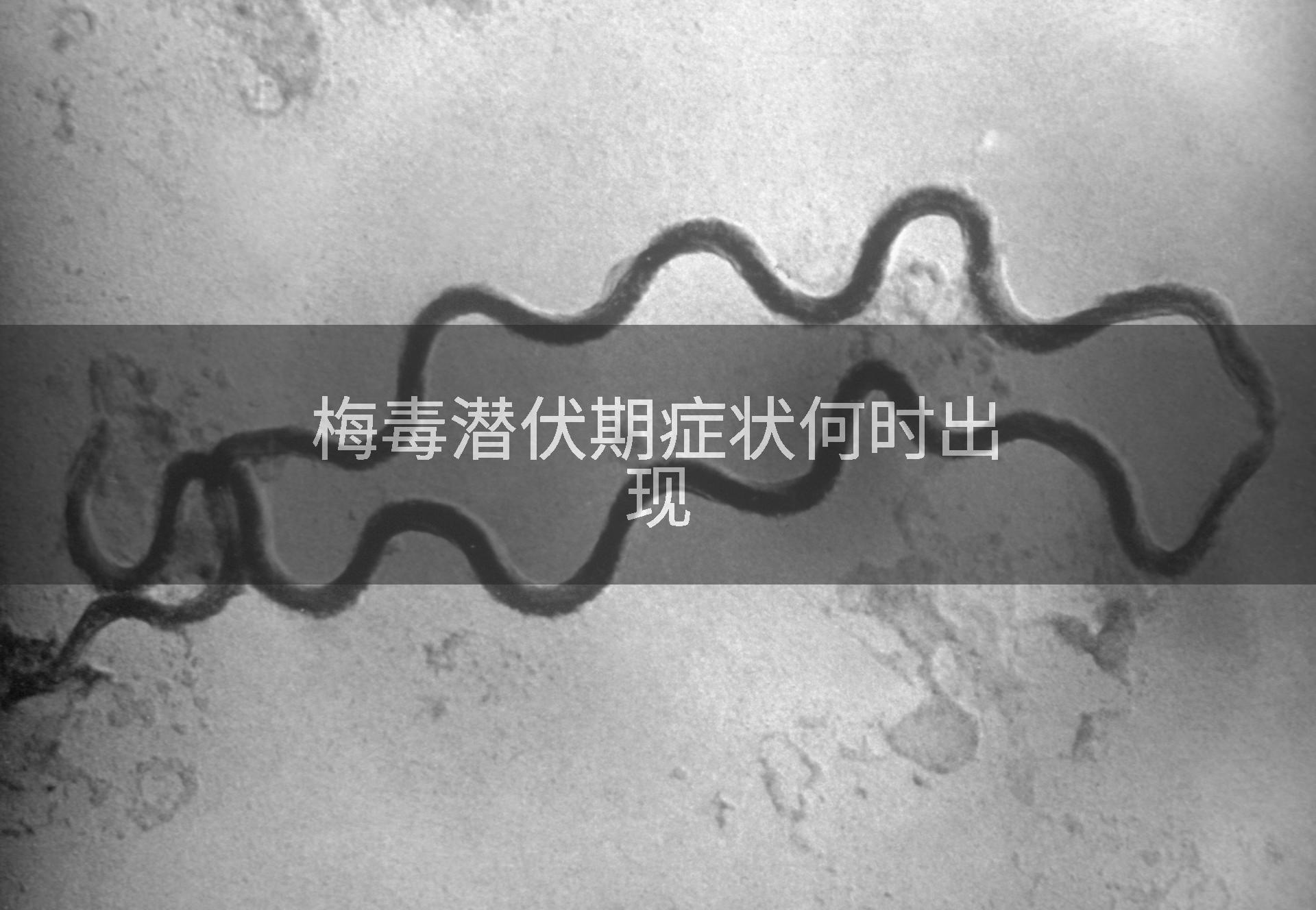梅毒潜伏期症状何时出现