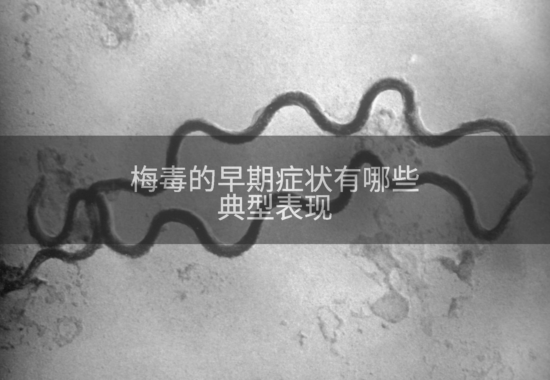 梅毒的早期症状有哪些典型表现