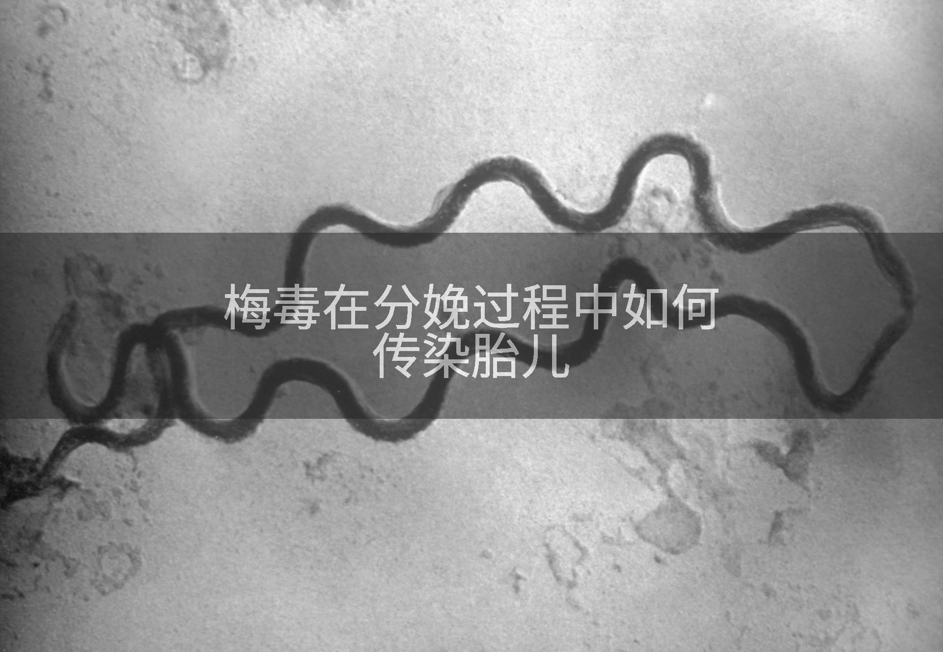 梅毒在分娩过程中如何传染胎儿