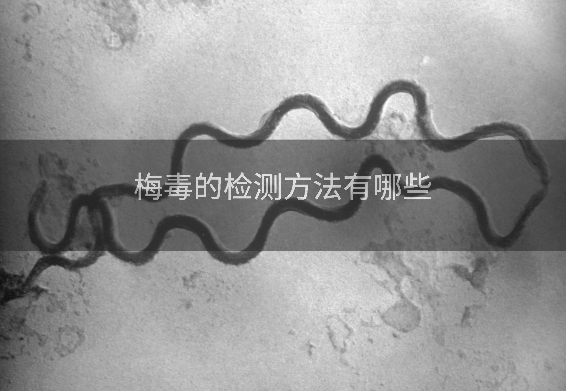 梅毒的检测方法有哪些