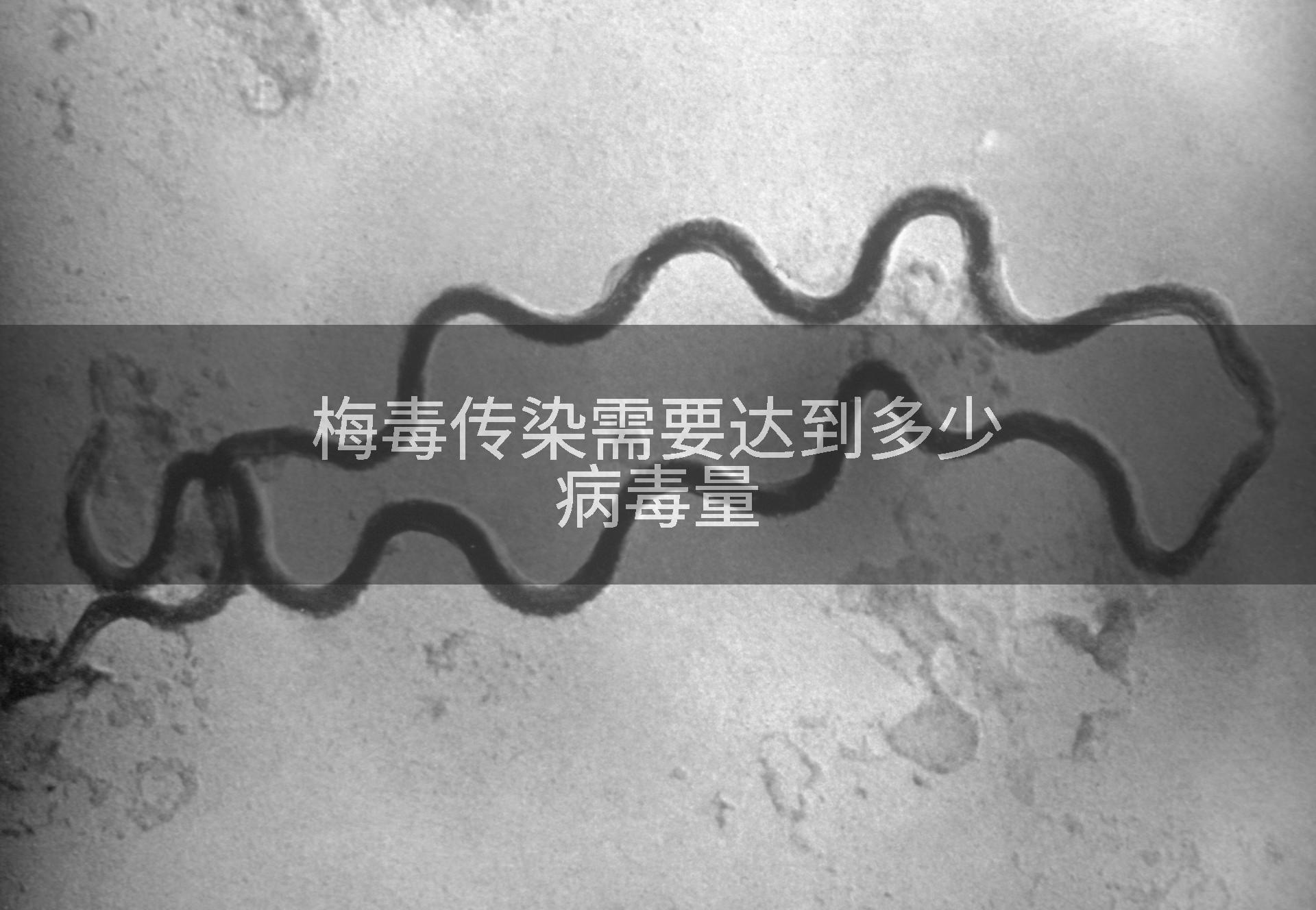 梅毒传染需要达到多少病毒量