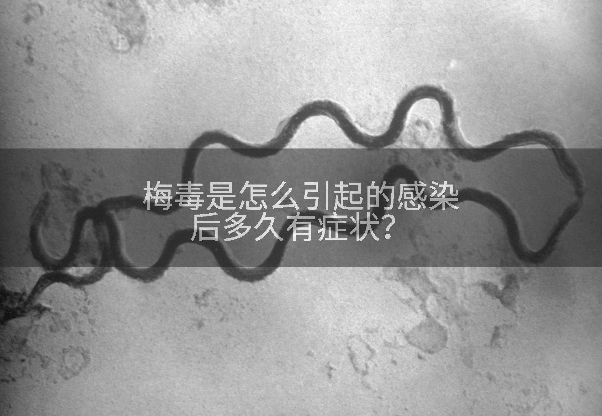 梅毒是怎么引起的感染后多久有症状？