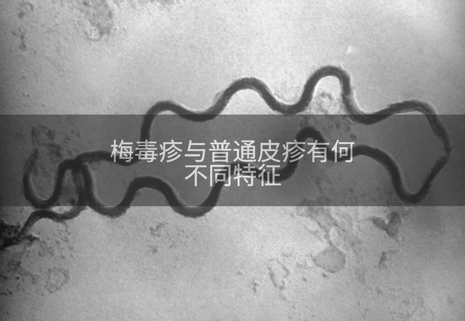 梅毒疹与普通皮疹有何不同特征