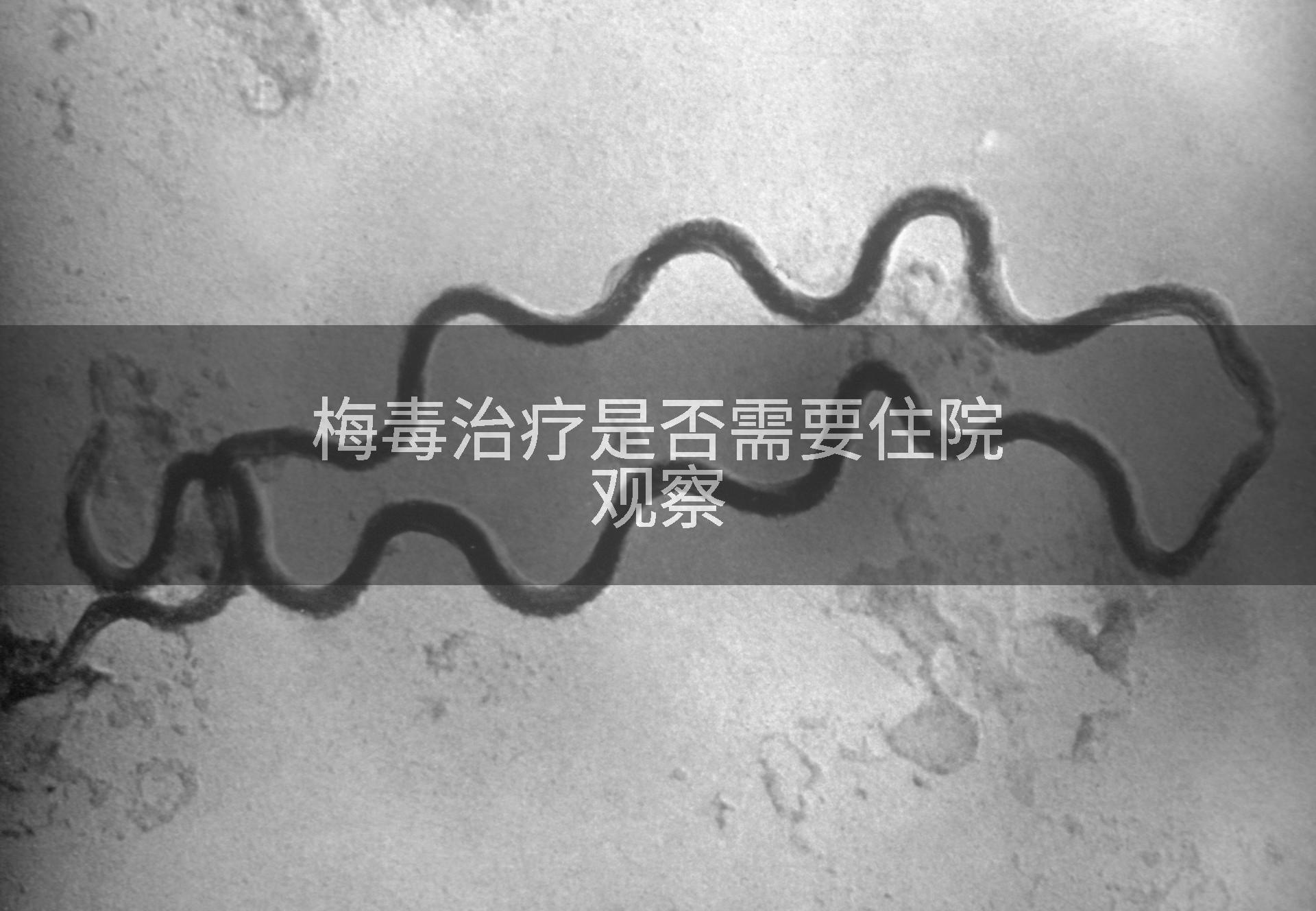 梅毒治疗是否需要住院观察