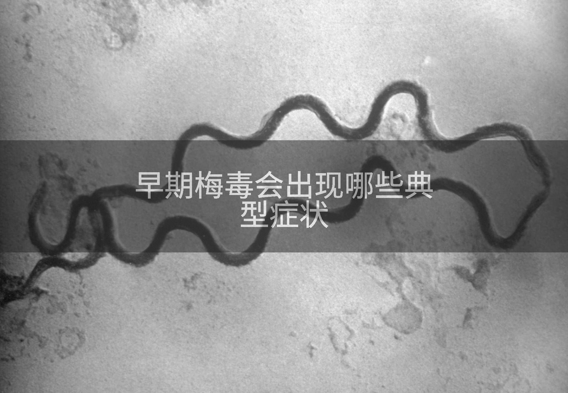 早期梅毒会出现哪些典型症状