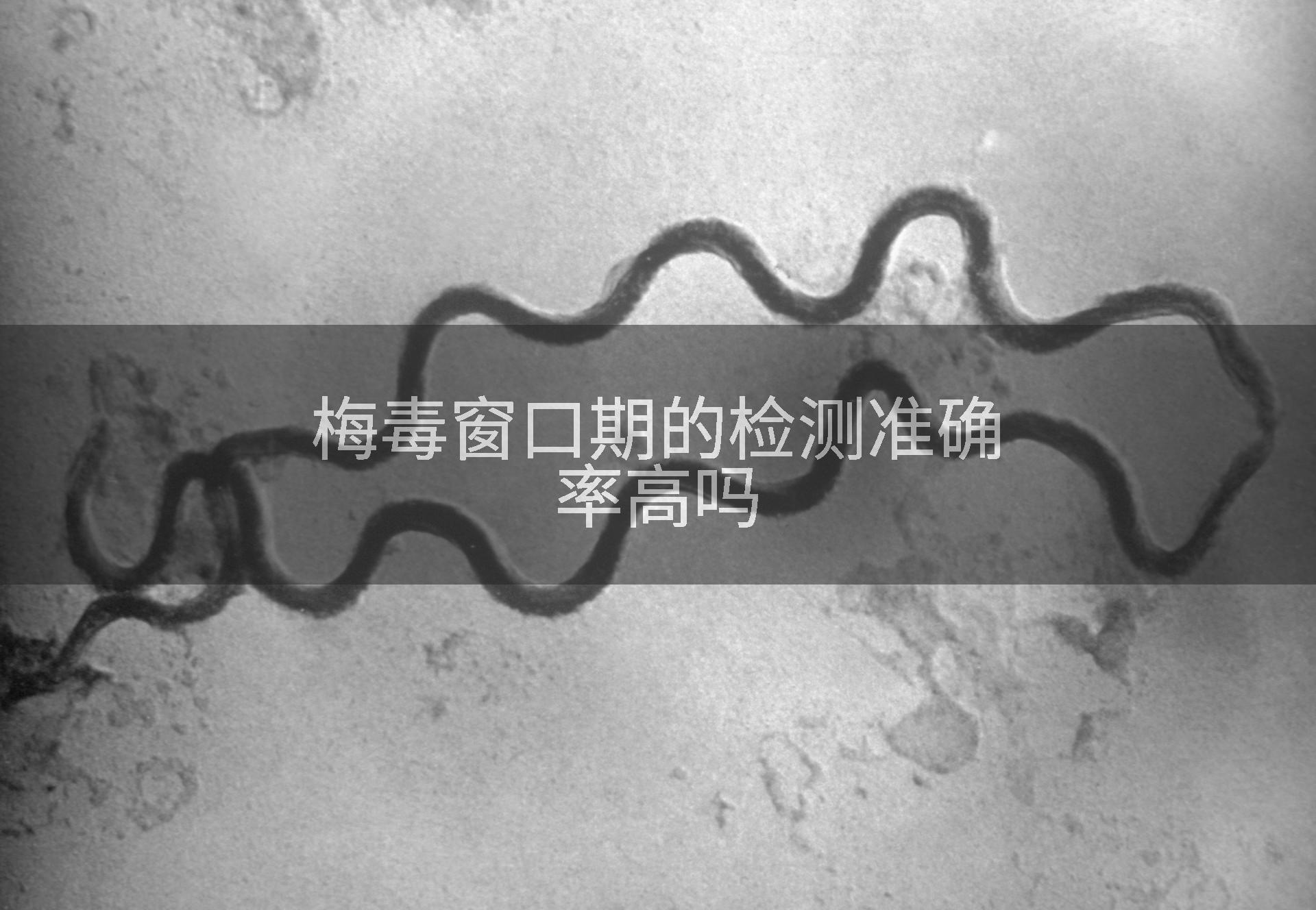 梅毒窗口期的检测准确率高吗