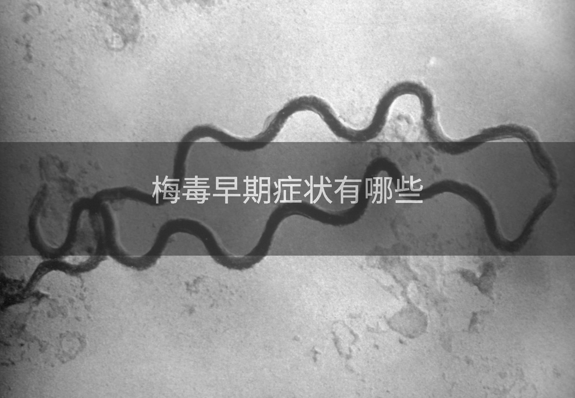 梅毒早期症状有哪些