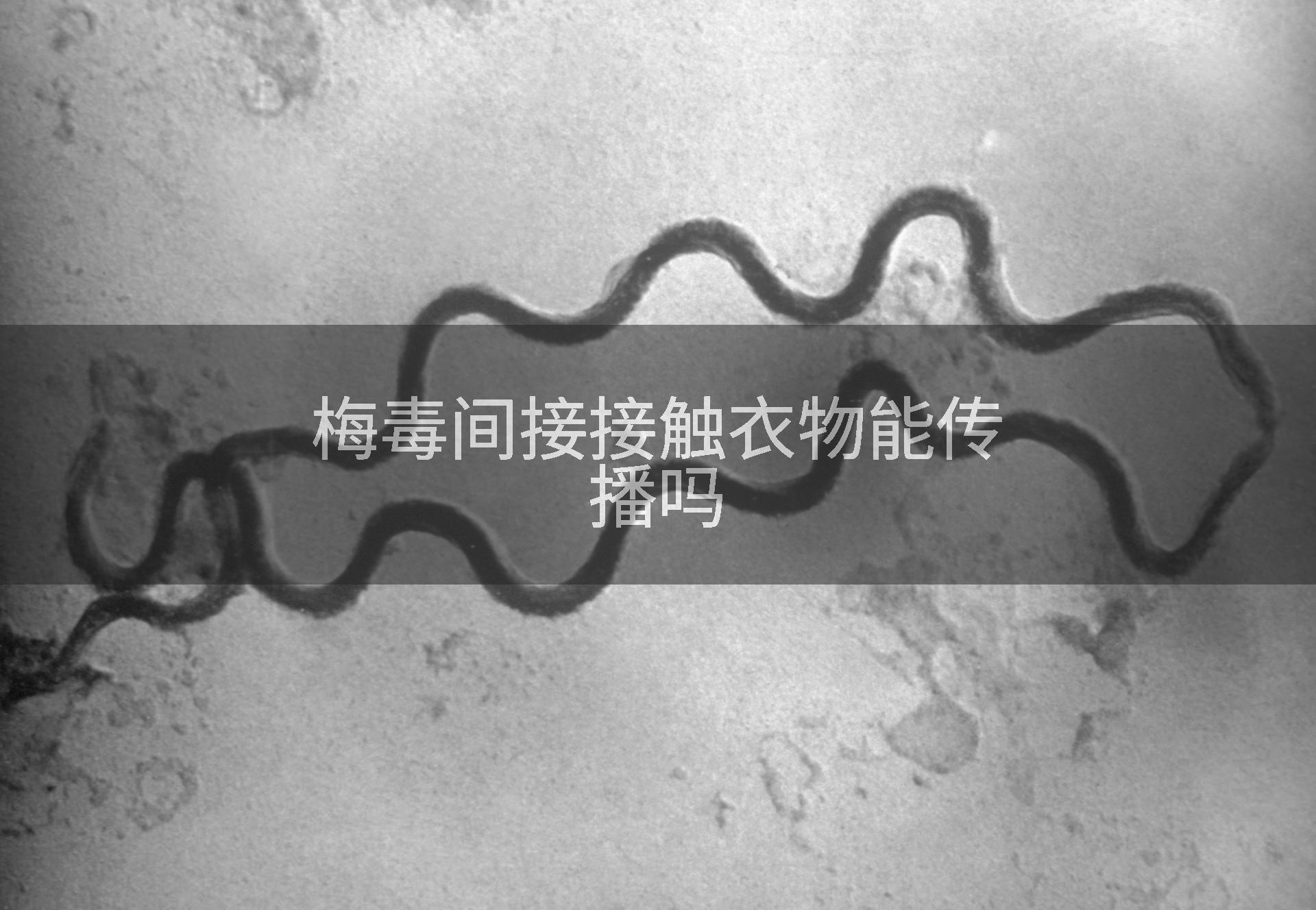 梅毒间接接触衣物能传播吗
