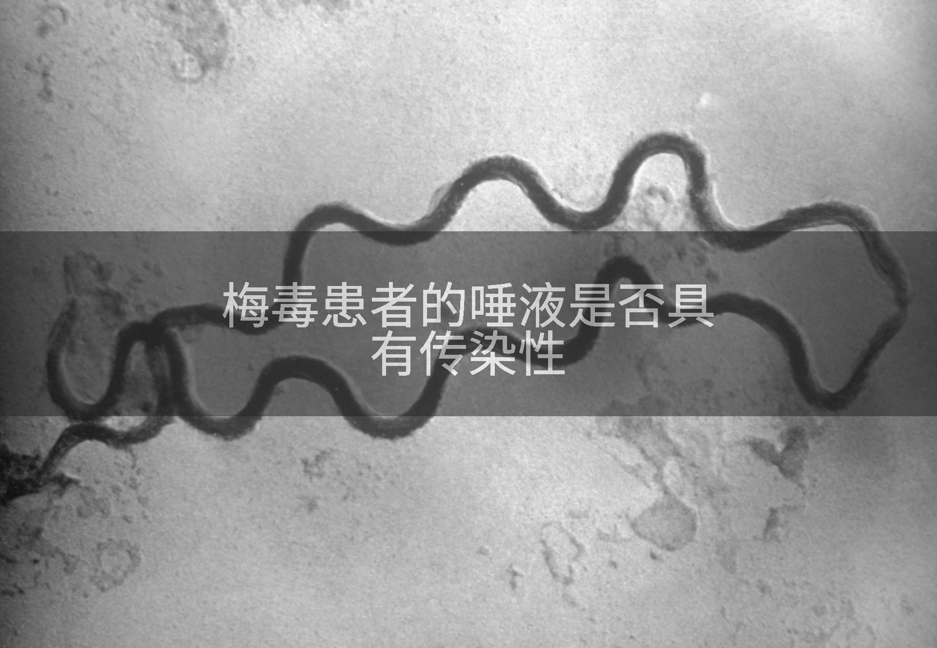 梅毒患者的唾液是否具有传染性