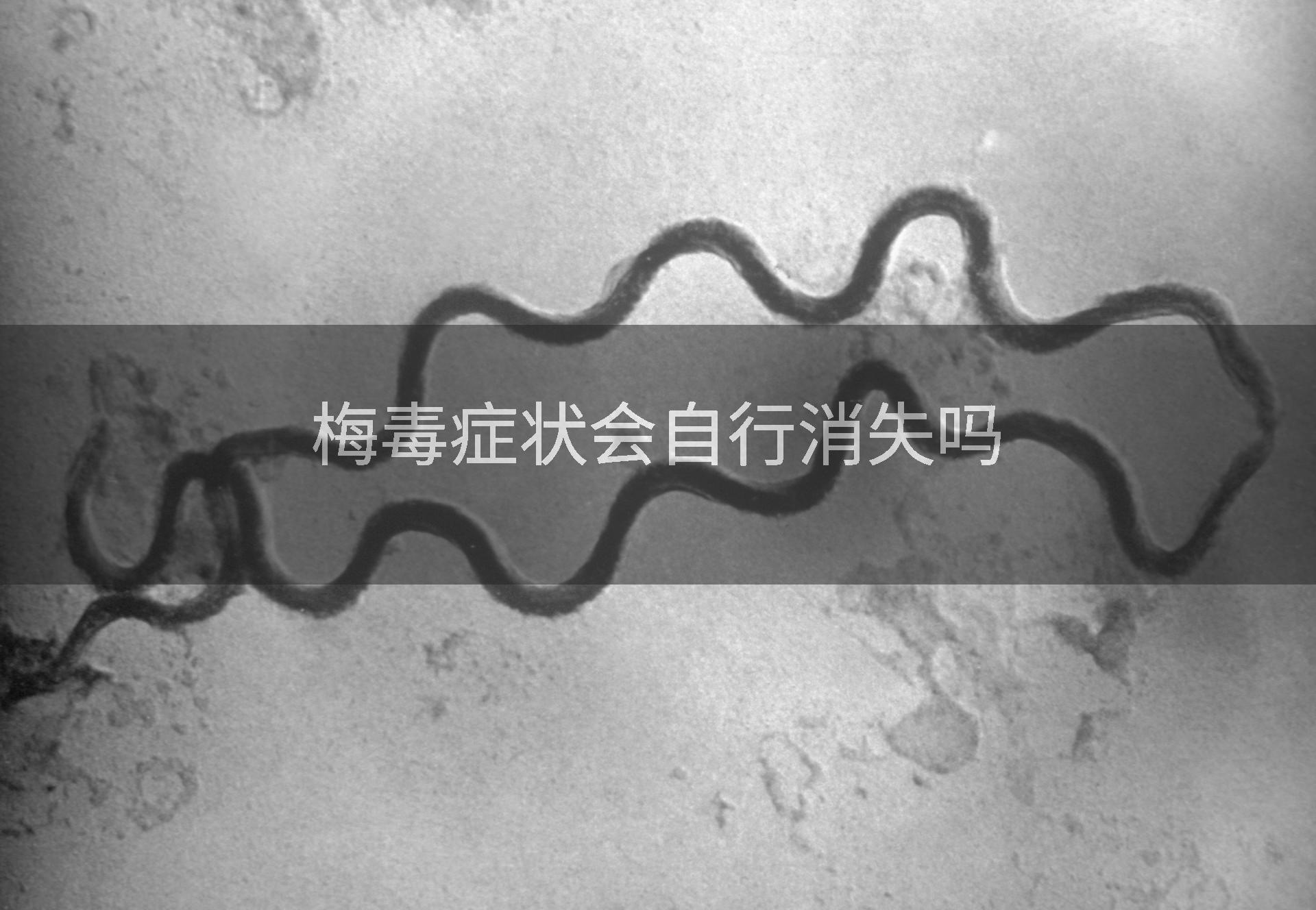 梅毒症状会自行消失吗