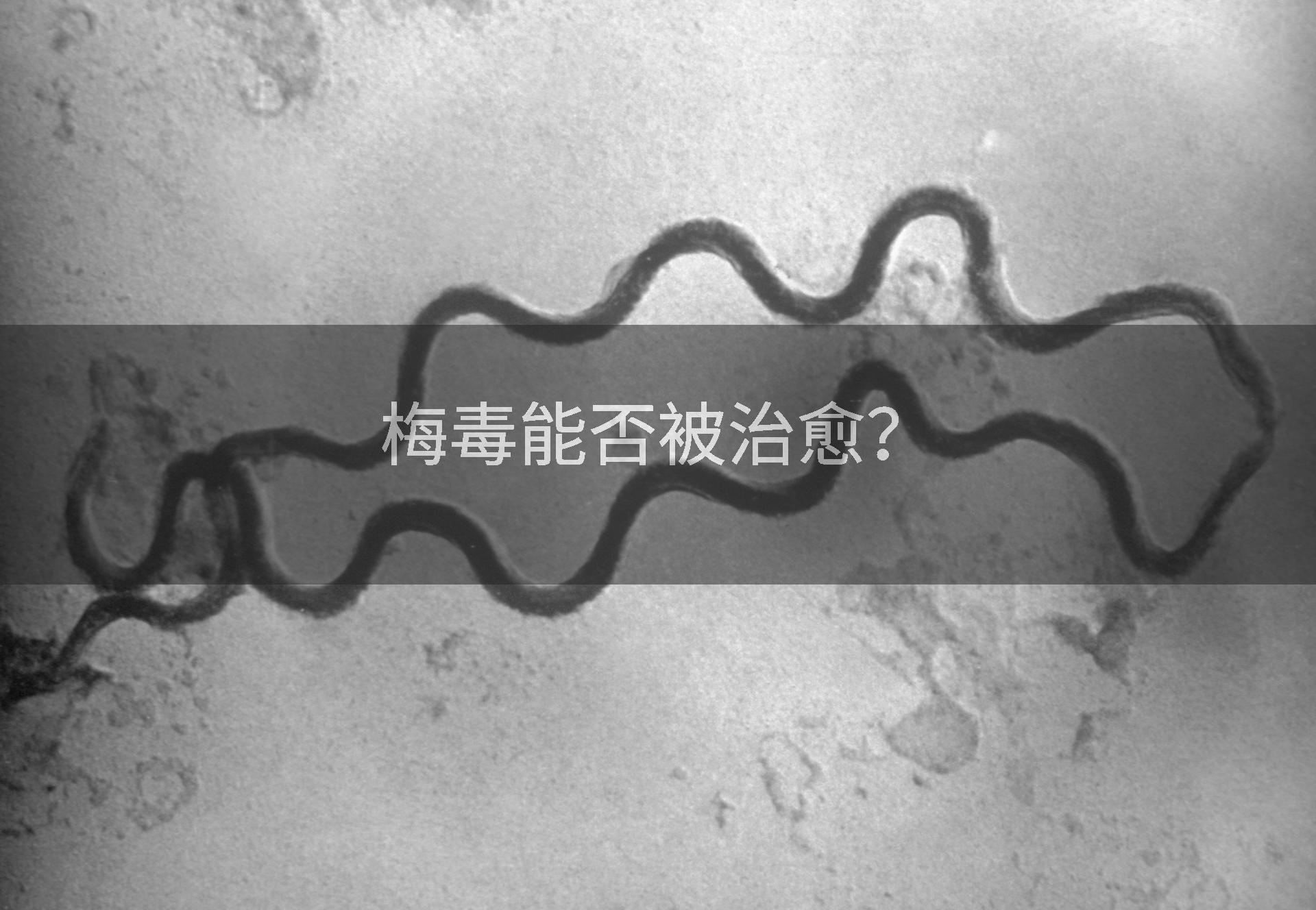 梅毒能否被治愈?