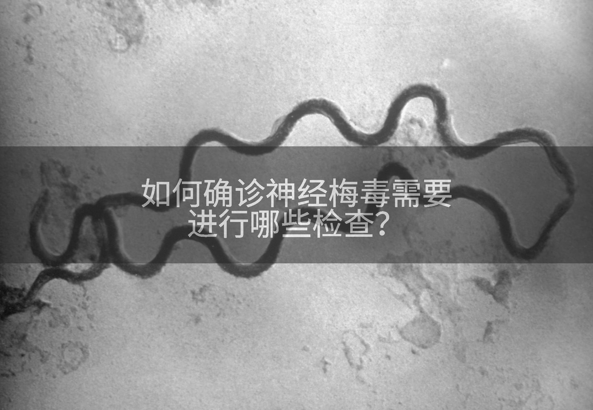如何确诊神经梅毒需要进行哪些检查?