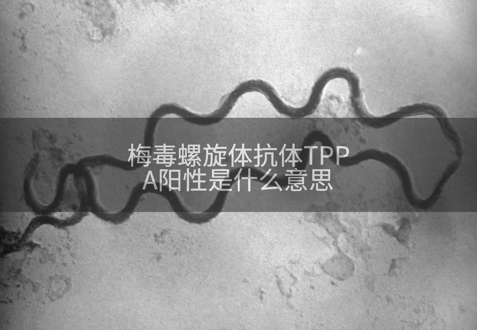 梅毒螺旋体抗体TPPA阳性是什么意思