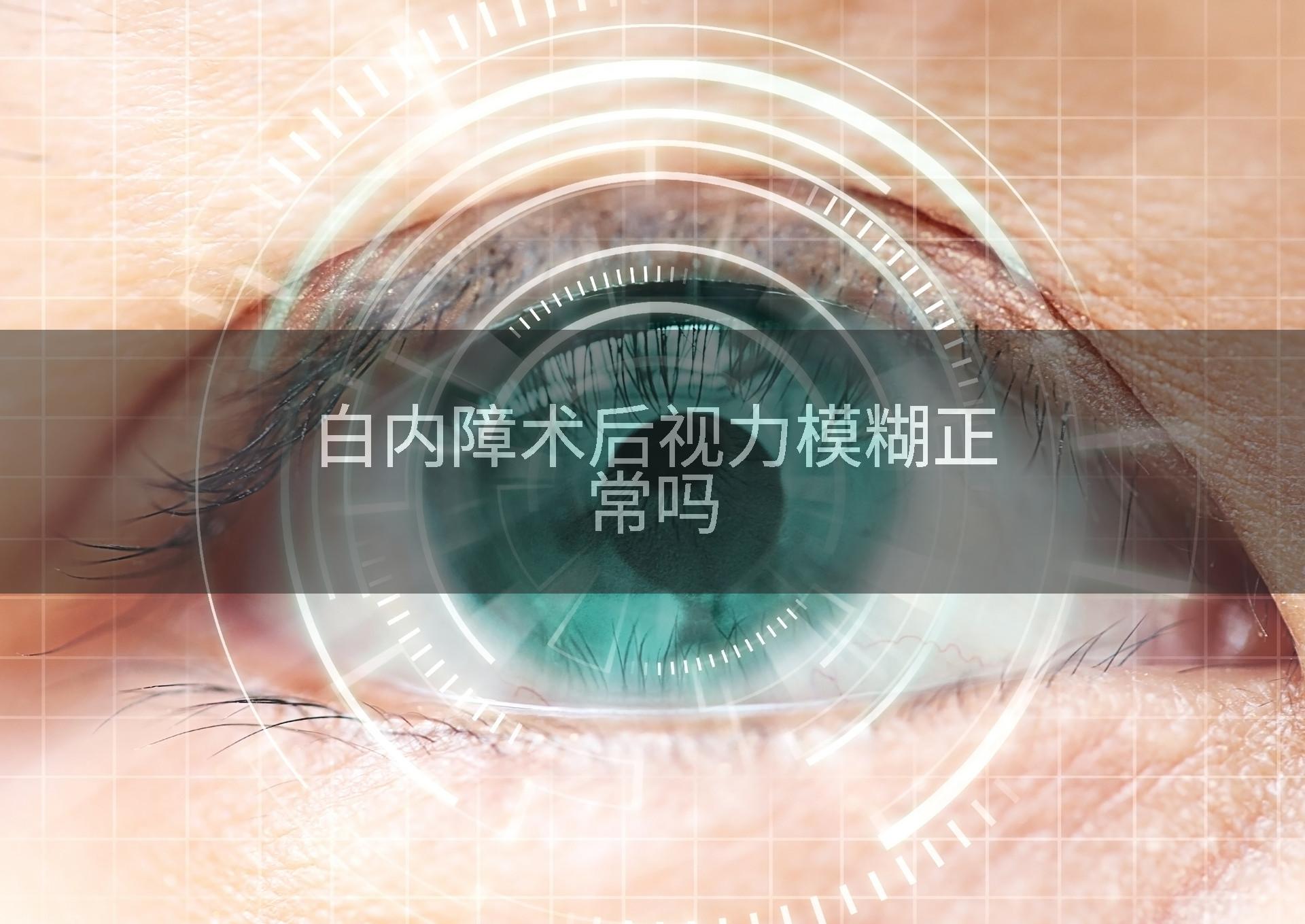 白内障术后视力模糊正常吗